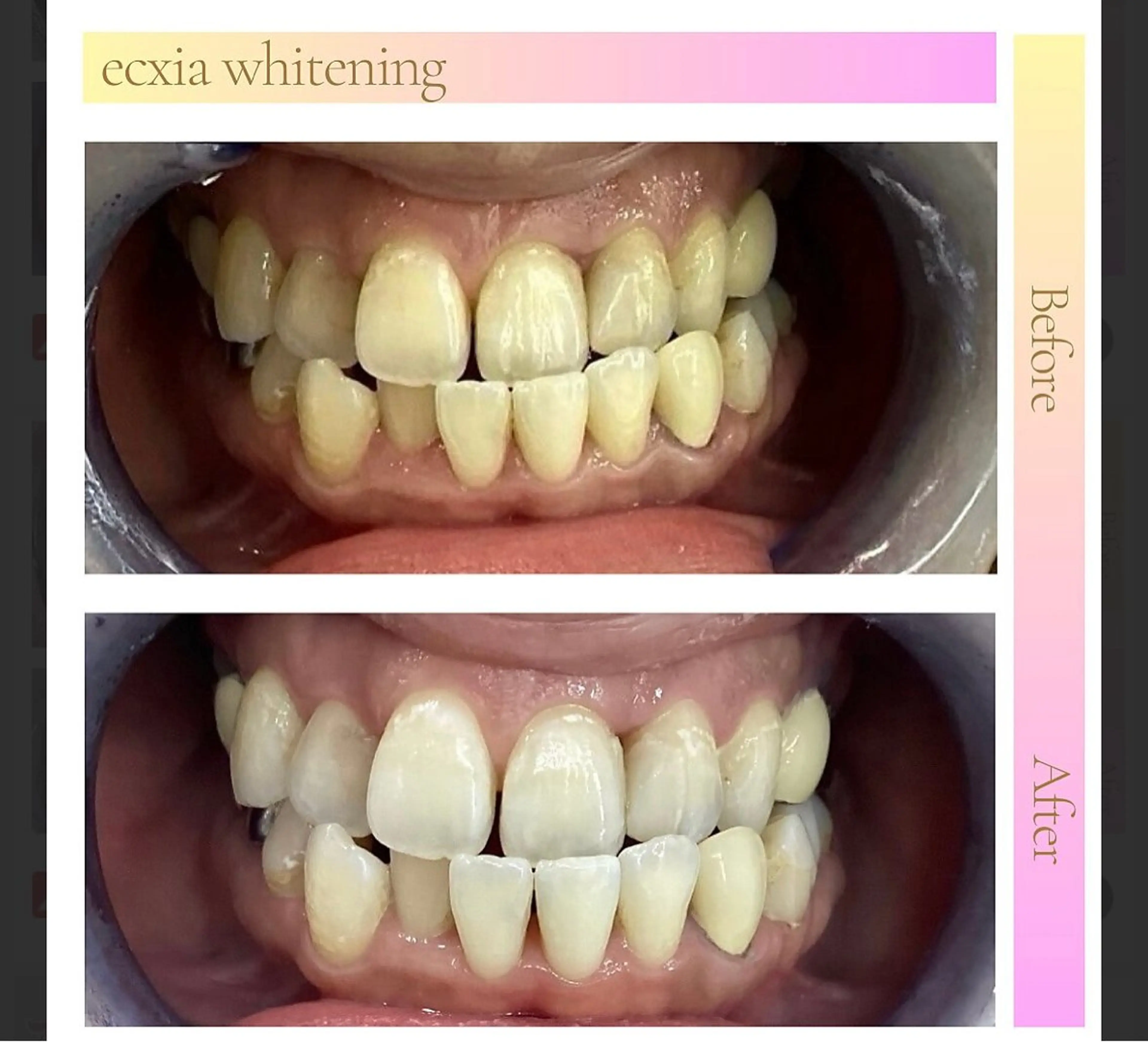 セルフホワイトニング　エクシア盛岡中央通店所属・セルフホワイトニング エクシア盛岡あっくんのエステ・リラクイメージ