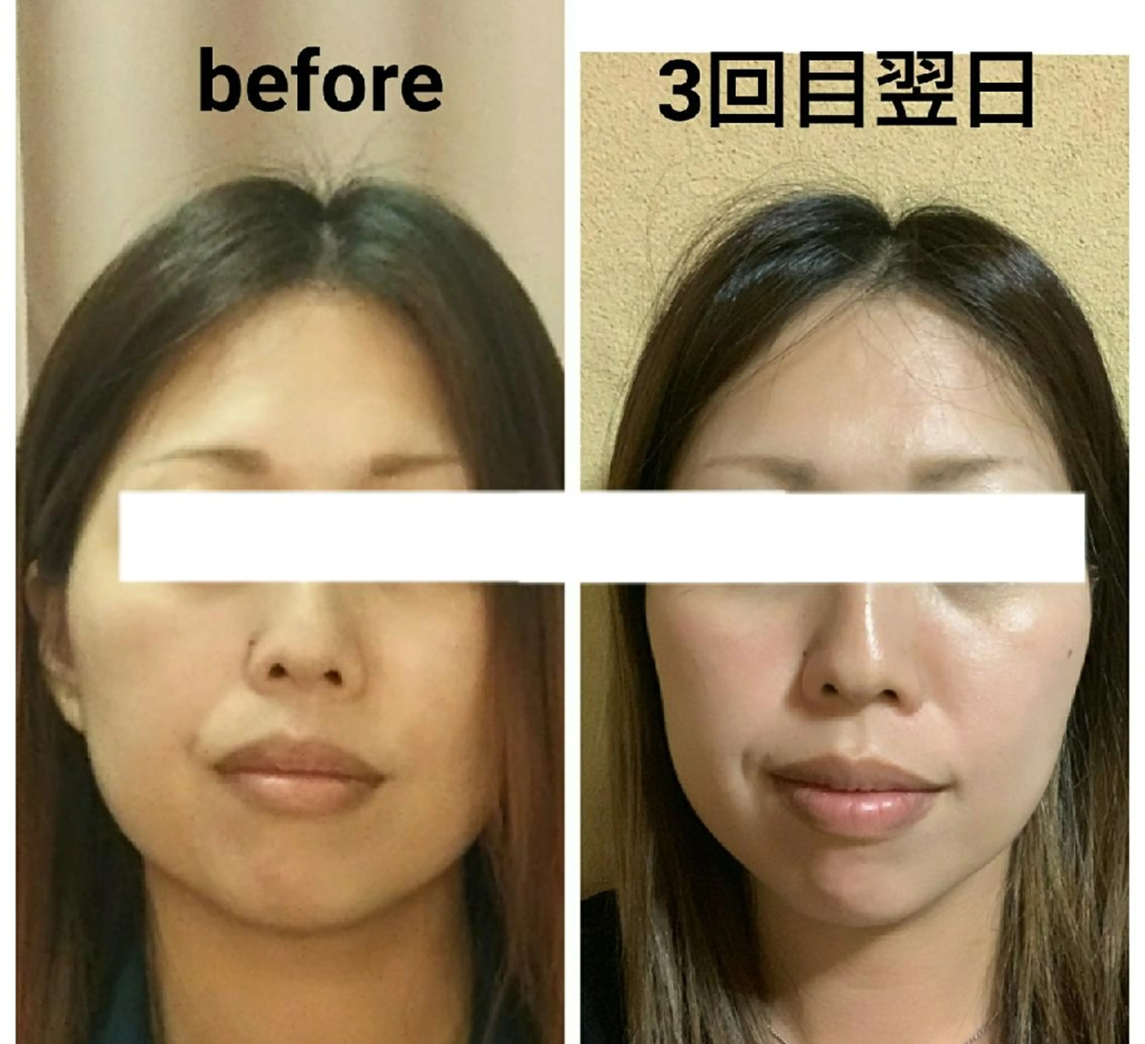 小顔と美肌 まごころエステMatoria所属・小顔 美肌専門 Matoriaのエステ・リラクイメージ