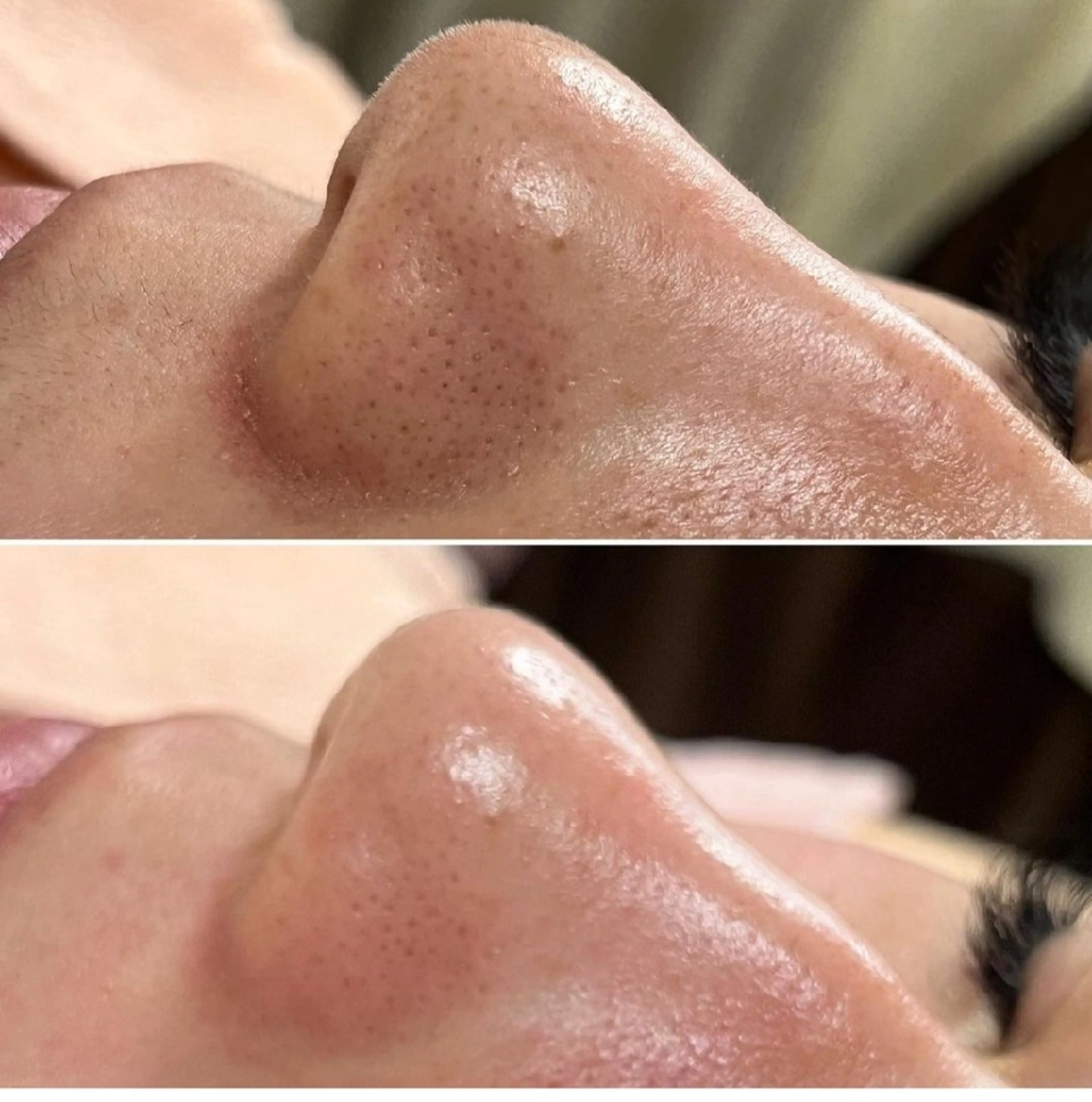 Premier 所属・寺西 さくらのエステ・リラクイメージ