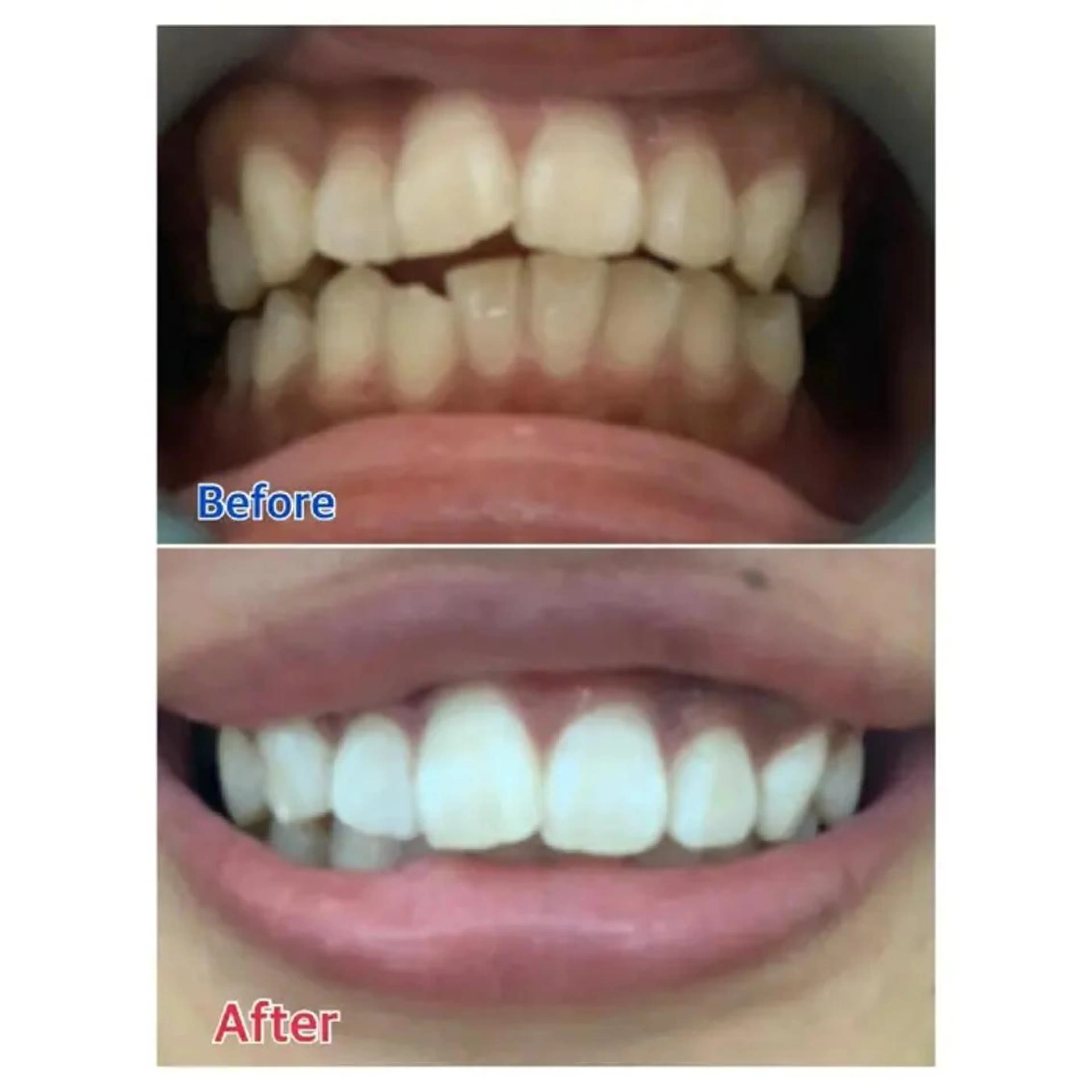 M渋谷店所属・M渋谷 ホワイトニングのエステ・リラクイメージ