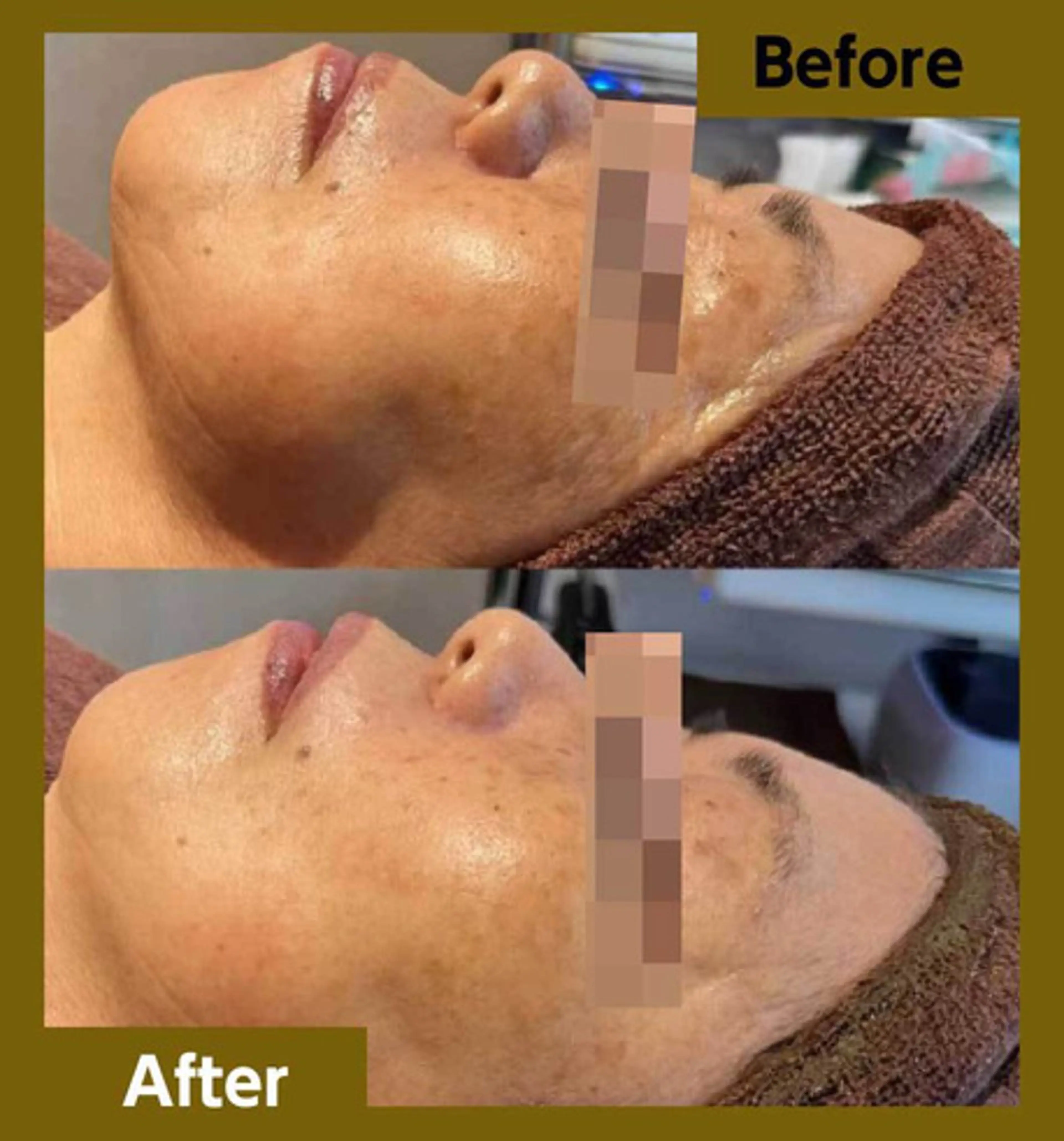 CHARMER 韓国式美肌サロンの眉毛・アイブロウイメージ