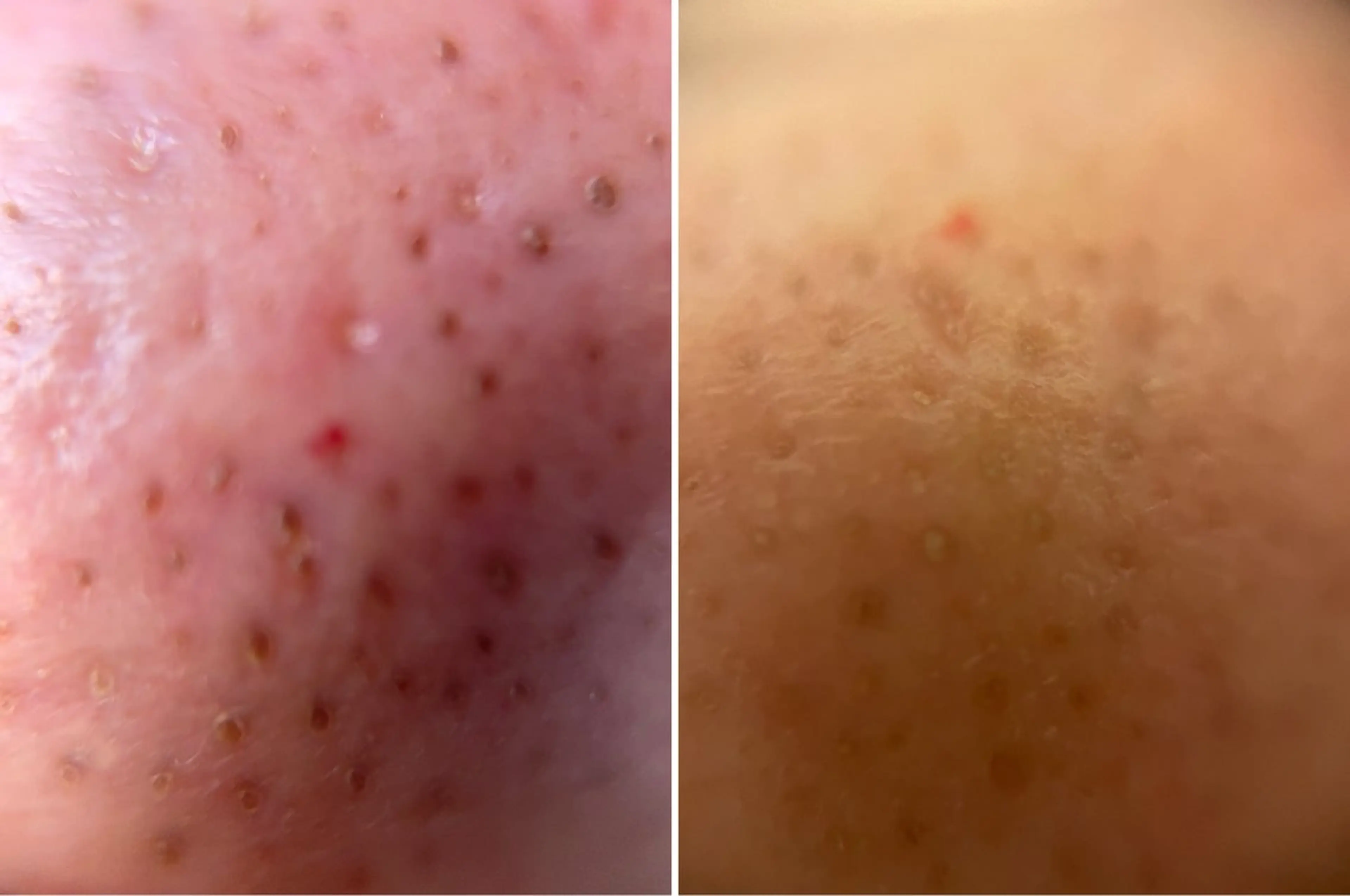 DeI'm豊岡店所属・岸本 みゆ妃のエステ・リラクイメージ