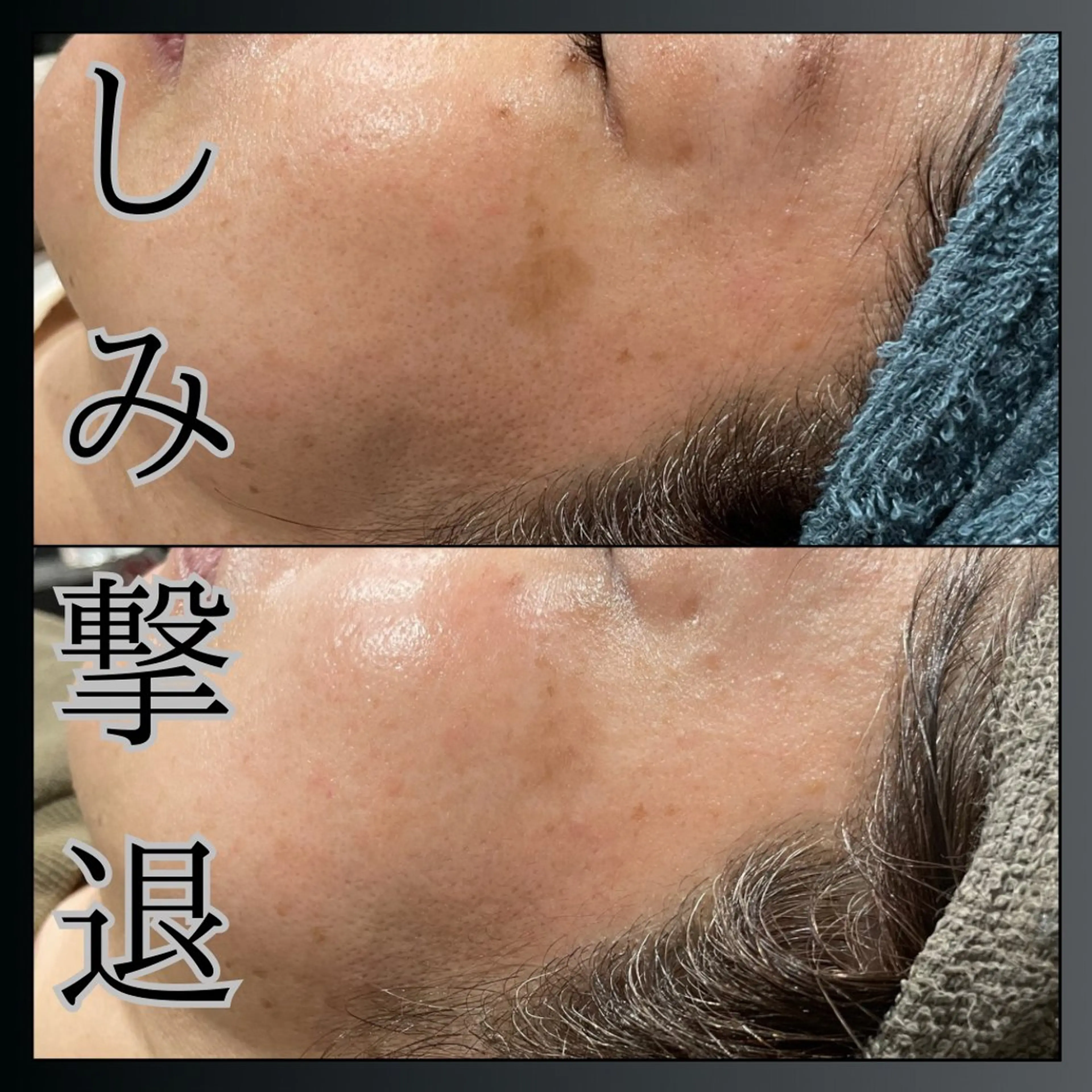 エステ LiZA エステティックサロンのエステ・リラクイメージ