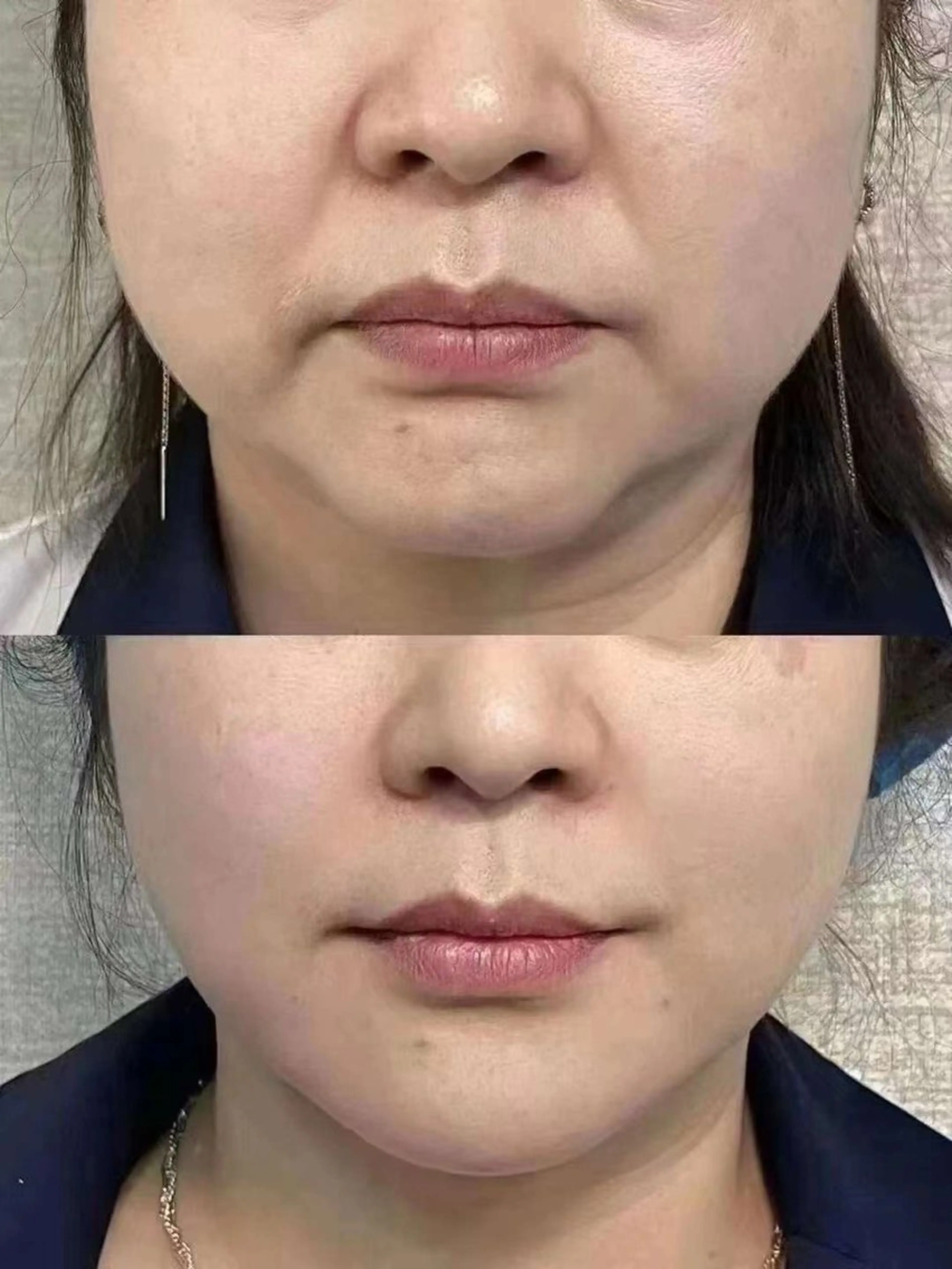 ネイル エステ aliaハイフ&水光ジェットサロン所属・aliaハーブ水光店 エステティシャン募集のエステ・リラクイメージ