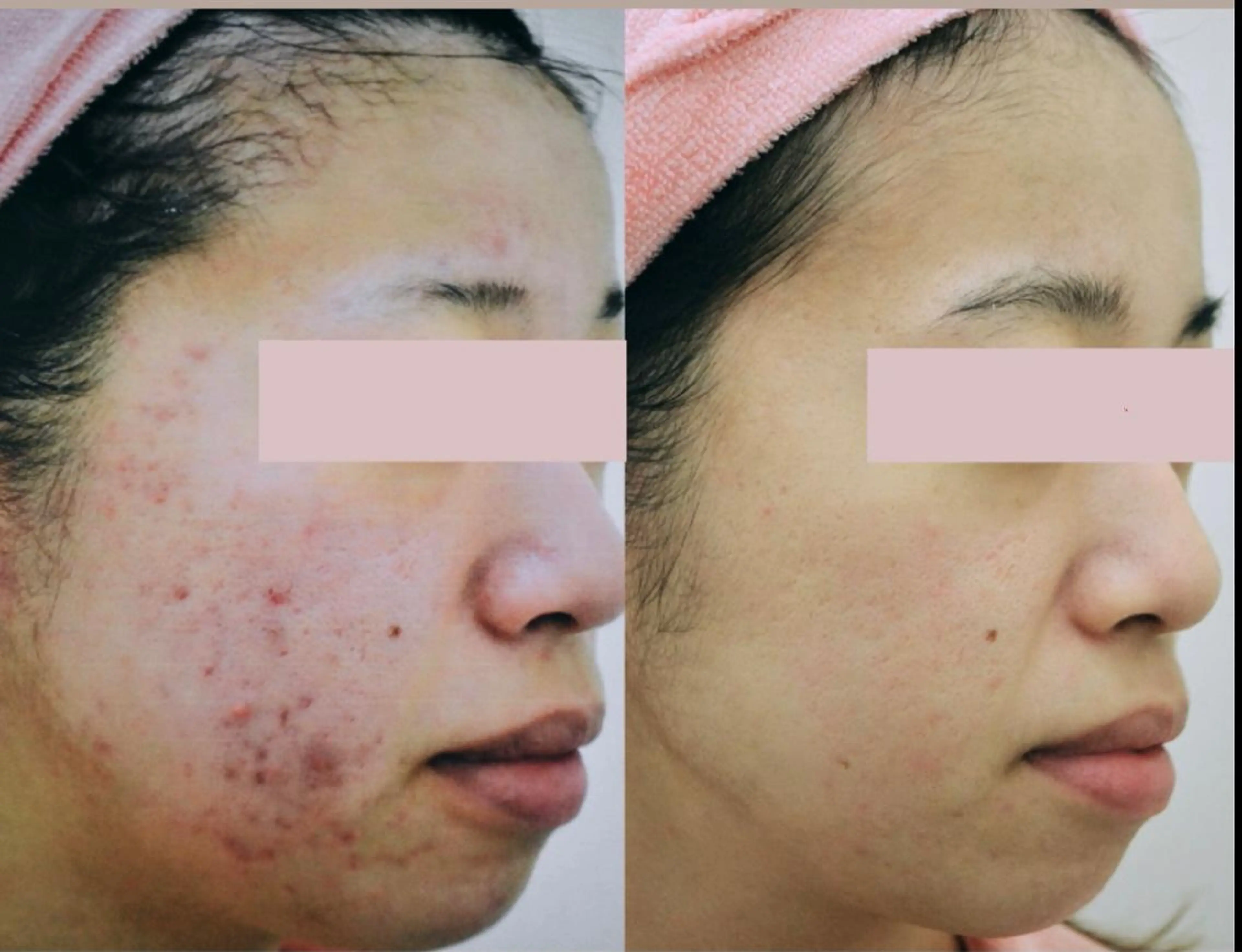 メンズ ネイル マツエク・マツパ アイブロウ エステ Anacia Beauty Salon所属・美肌脱毛&毛穴専門 Anaciaのエステ・リラクイメージ