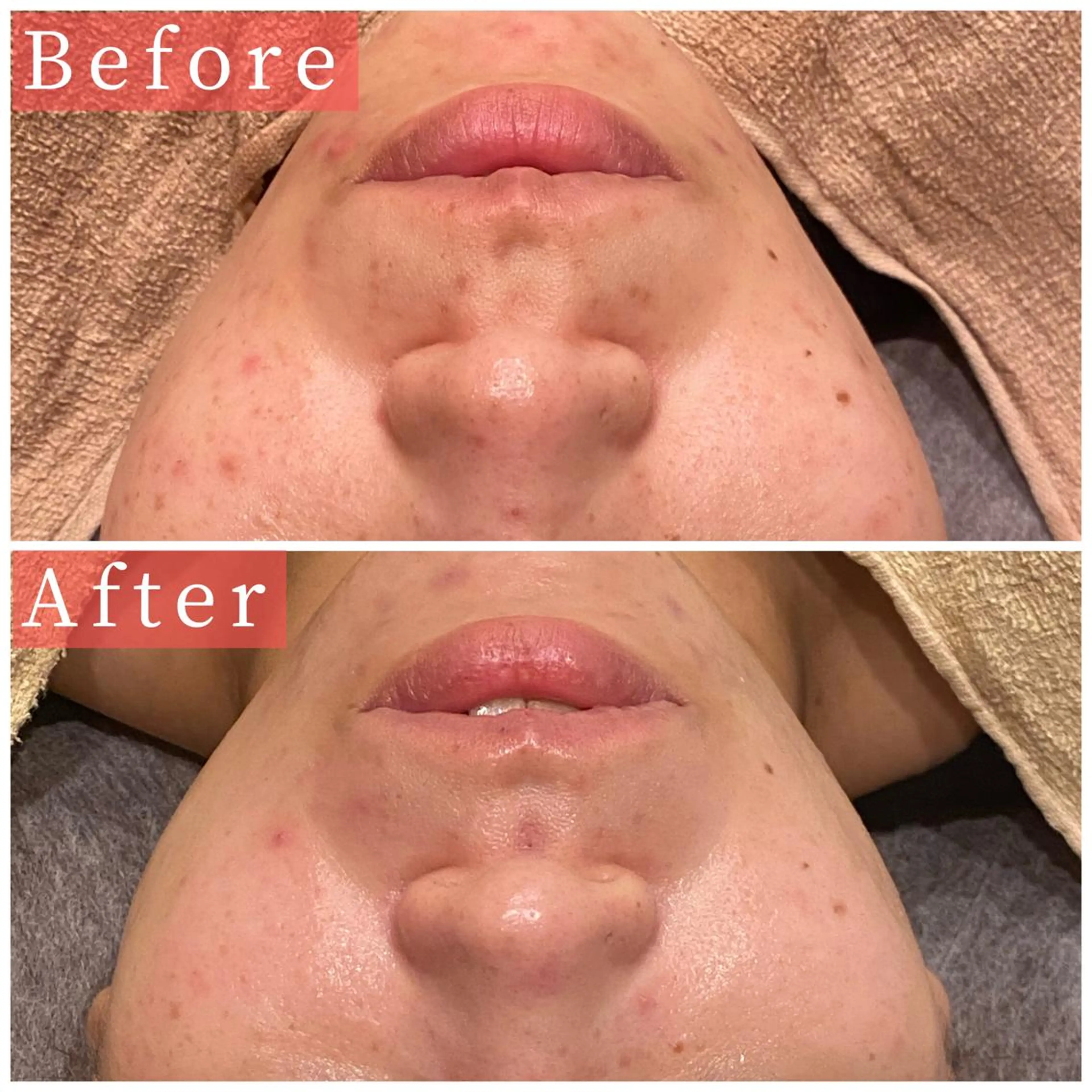 ハーブピーリング専門 muro.のエステ・リラクイメージ