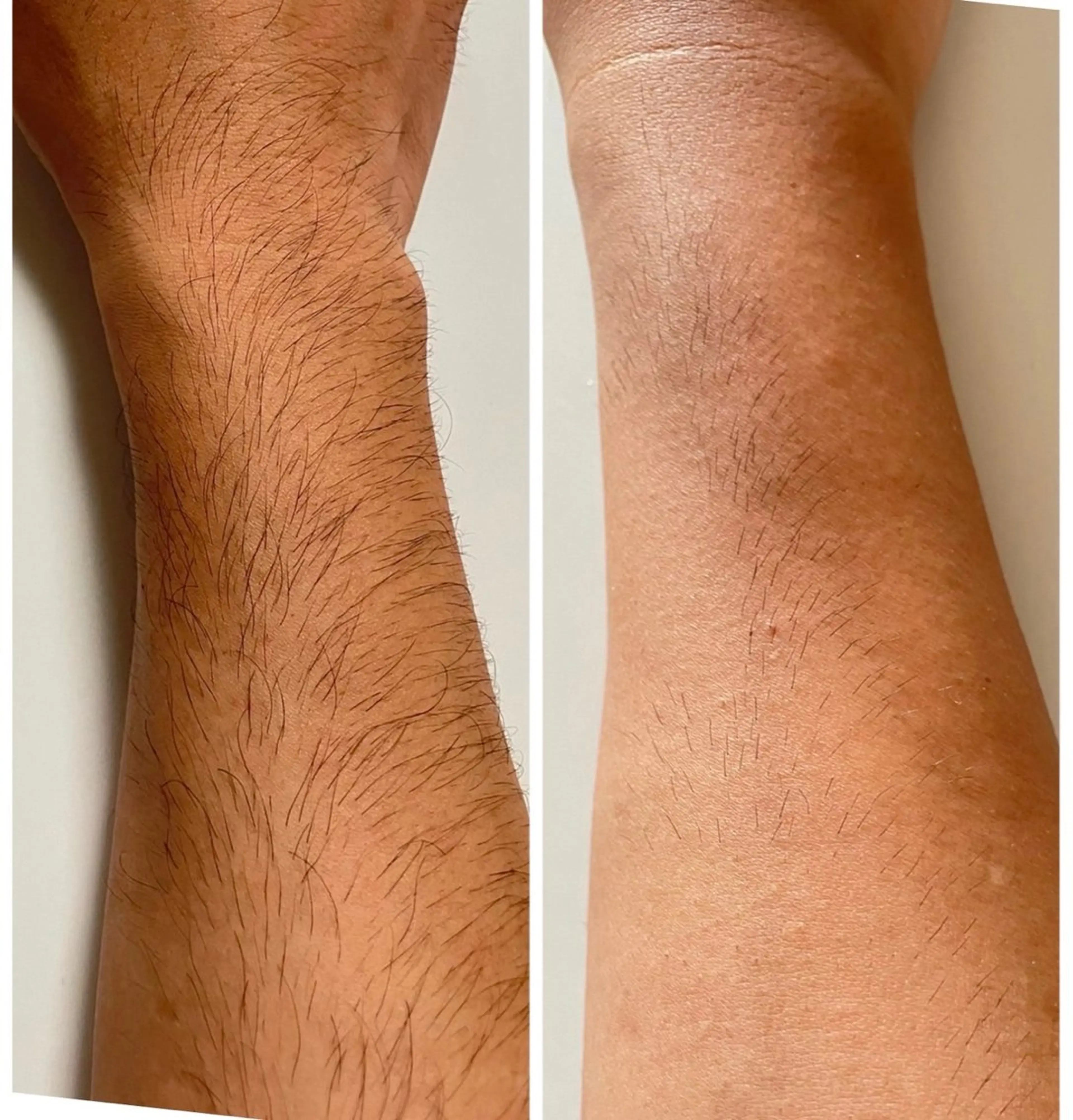 メンズ メンズ脱毛&エステ Passion所属・メンズ脱毛サロン Passionのエステ・リラクイメージ