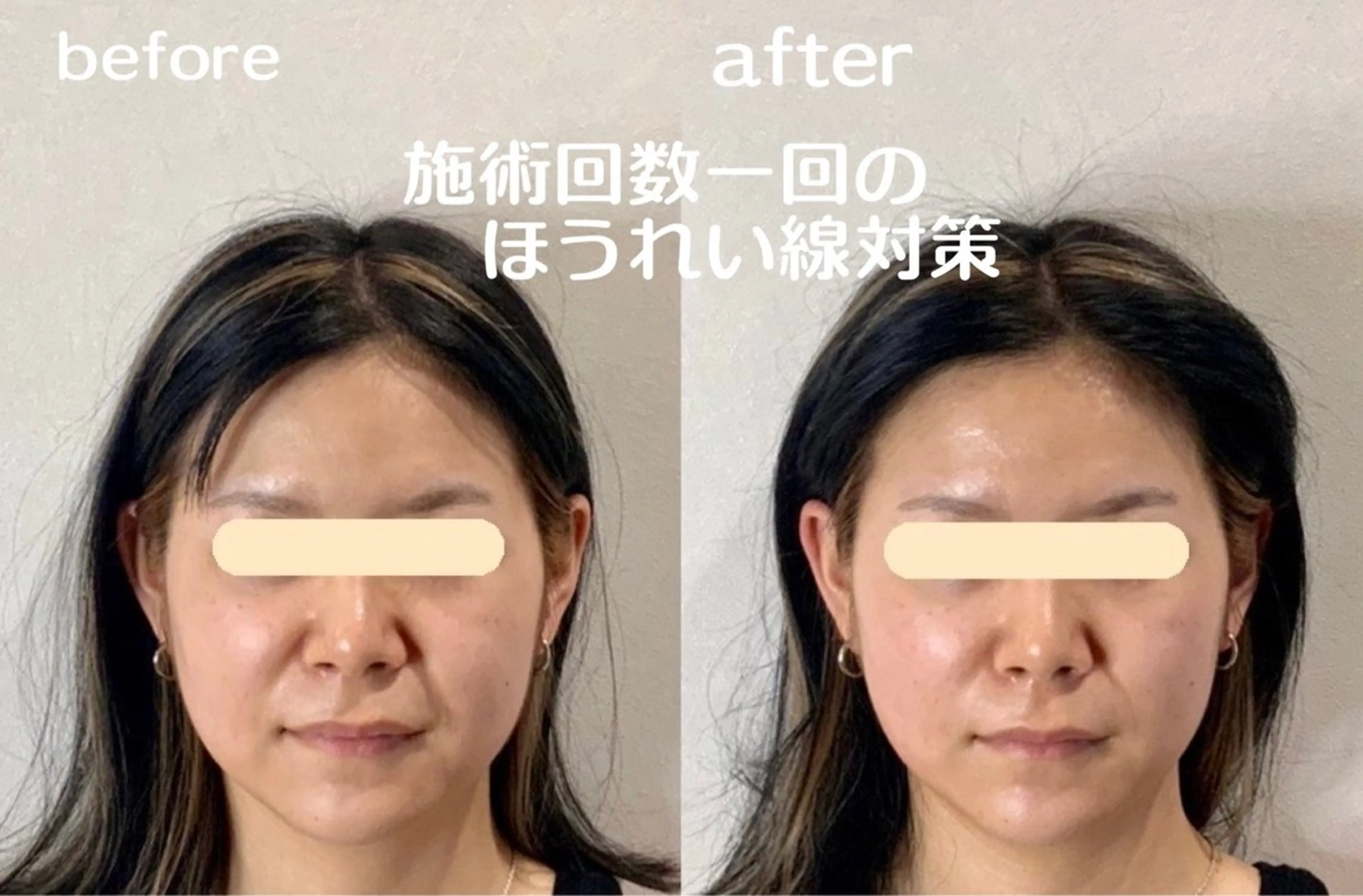 エステ 最速小顔・肌質管理 espoirマキのエステ・リラクイメージ