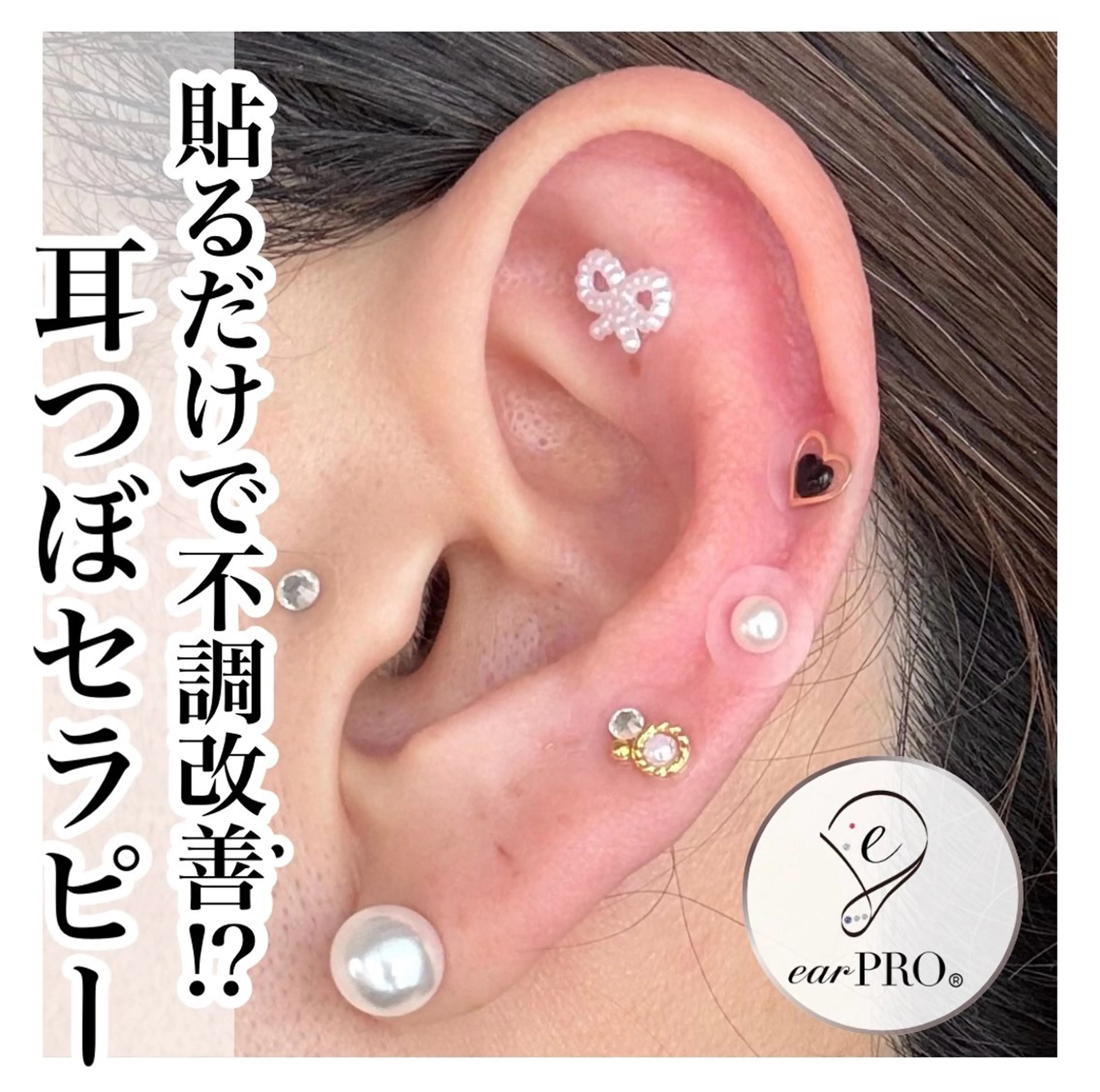 ラクして痩せる⁉︎ 貼るだけで不調改善☆話題沸騰中の耳つぼセラピー💎の写真