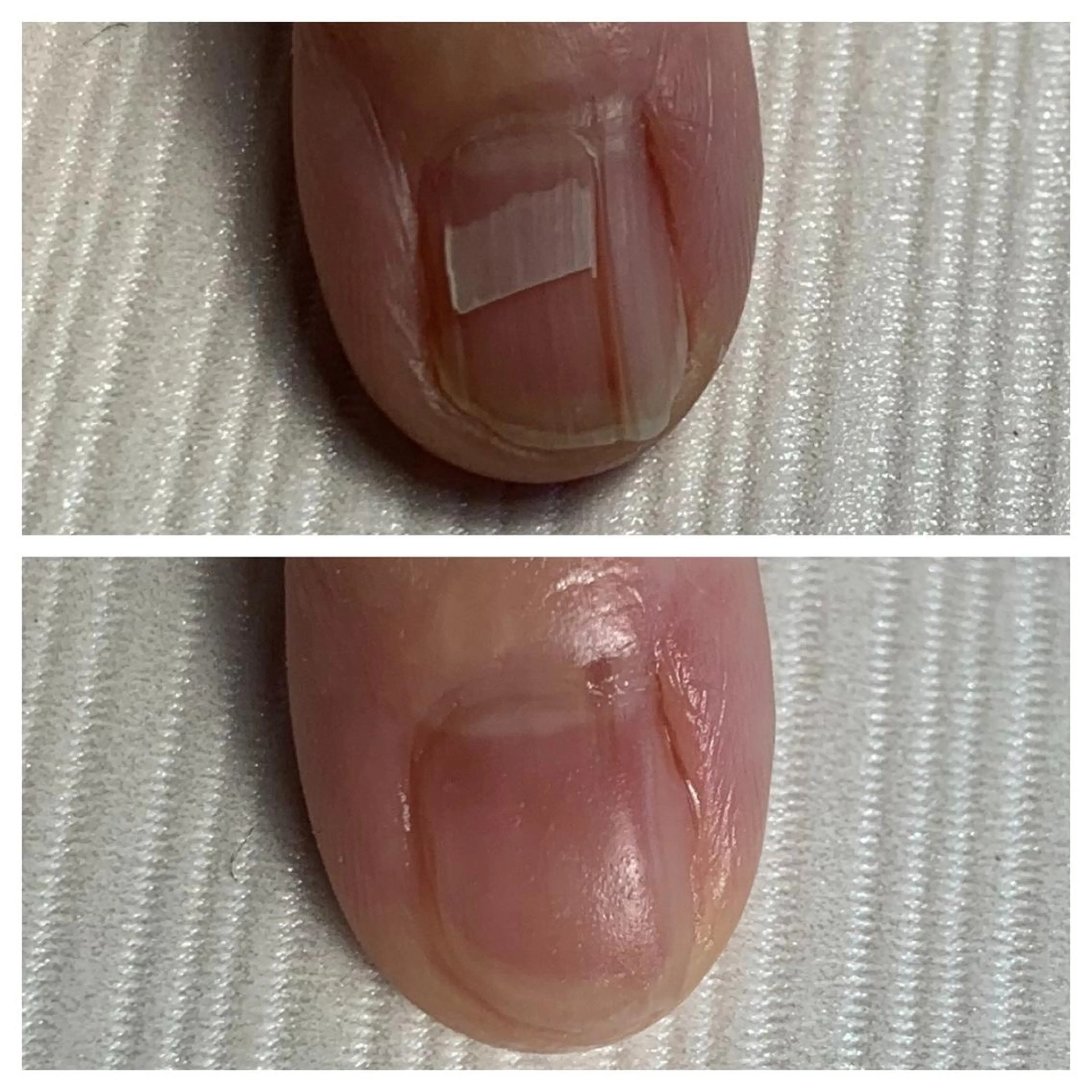 ネイル 大橋 愛のエステ・リラクイメージ