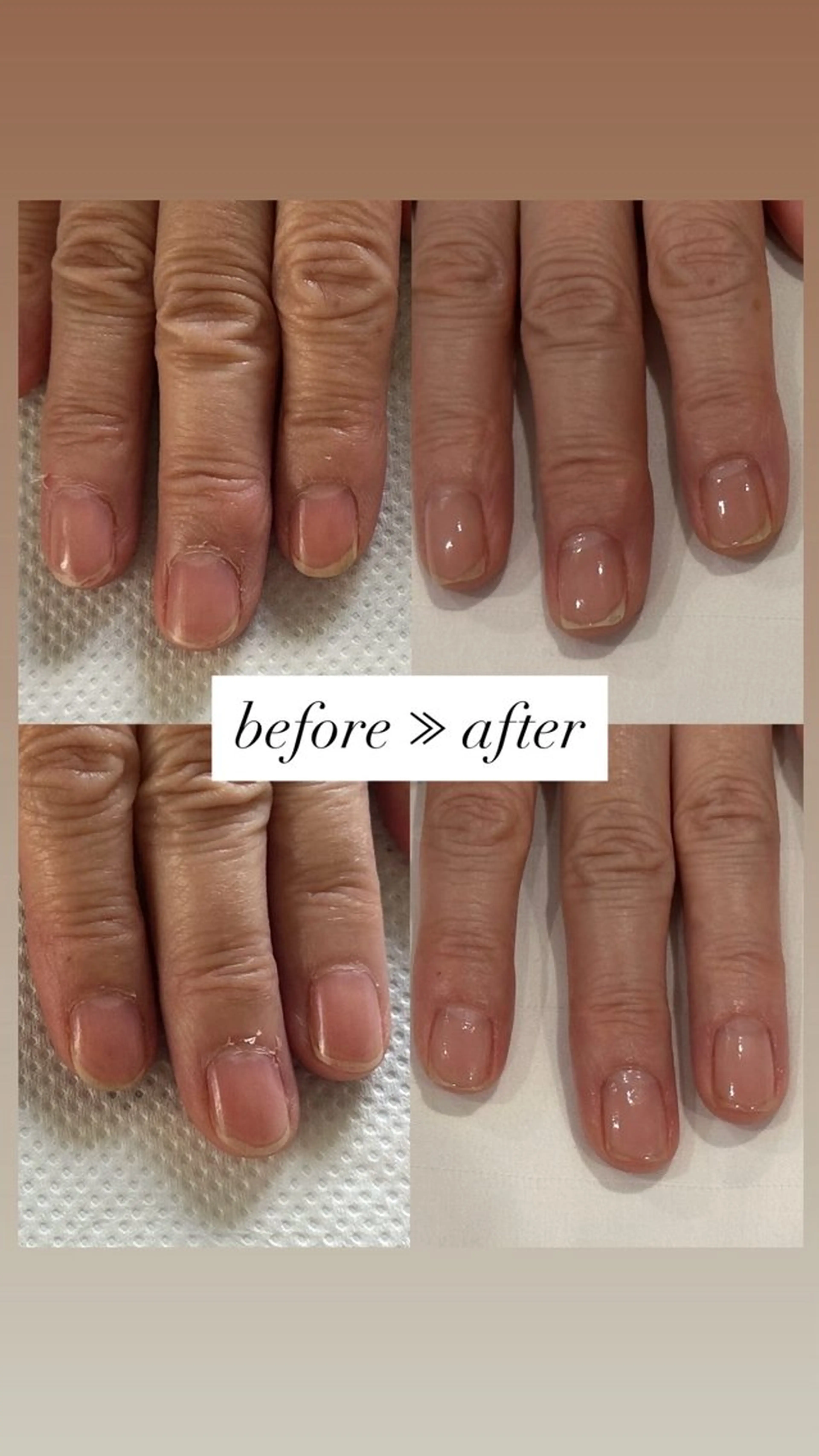 ネイル fote-自爪育成 ネイルケアサロン-のネイルデザイン