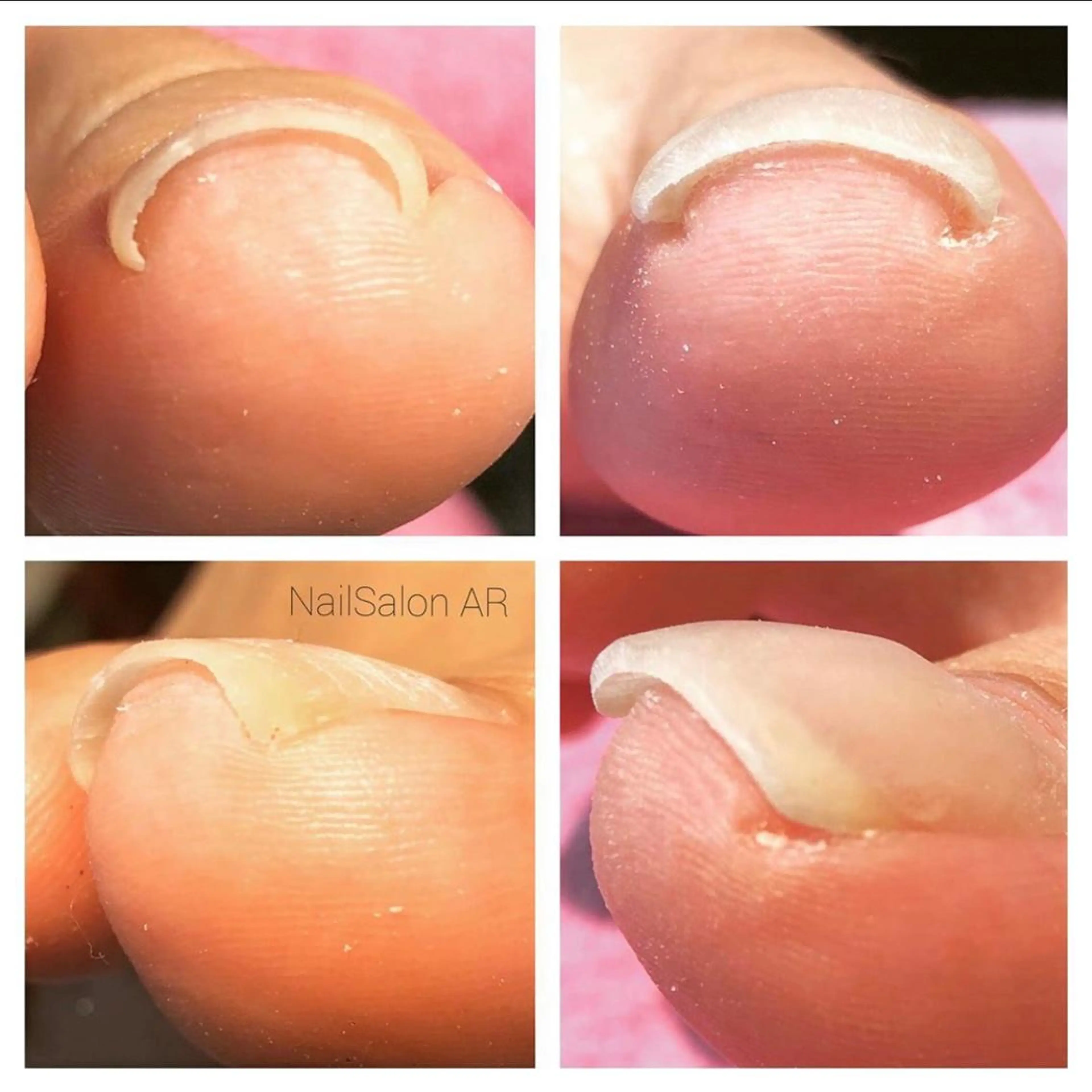 ネイルサロンAR 聖蹟桜ヶ丘店のネイルデザイン