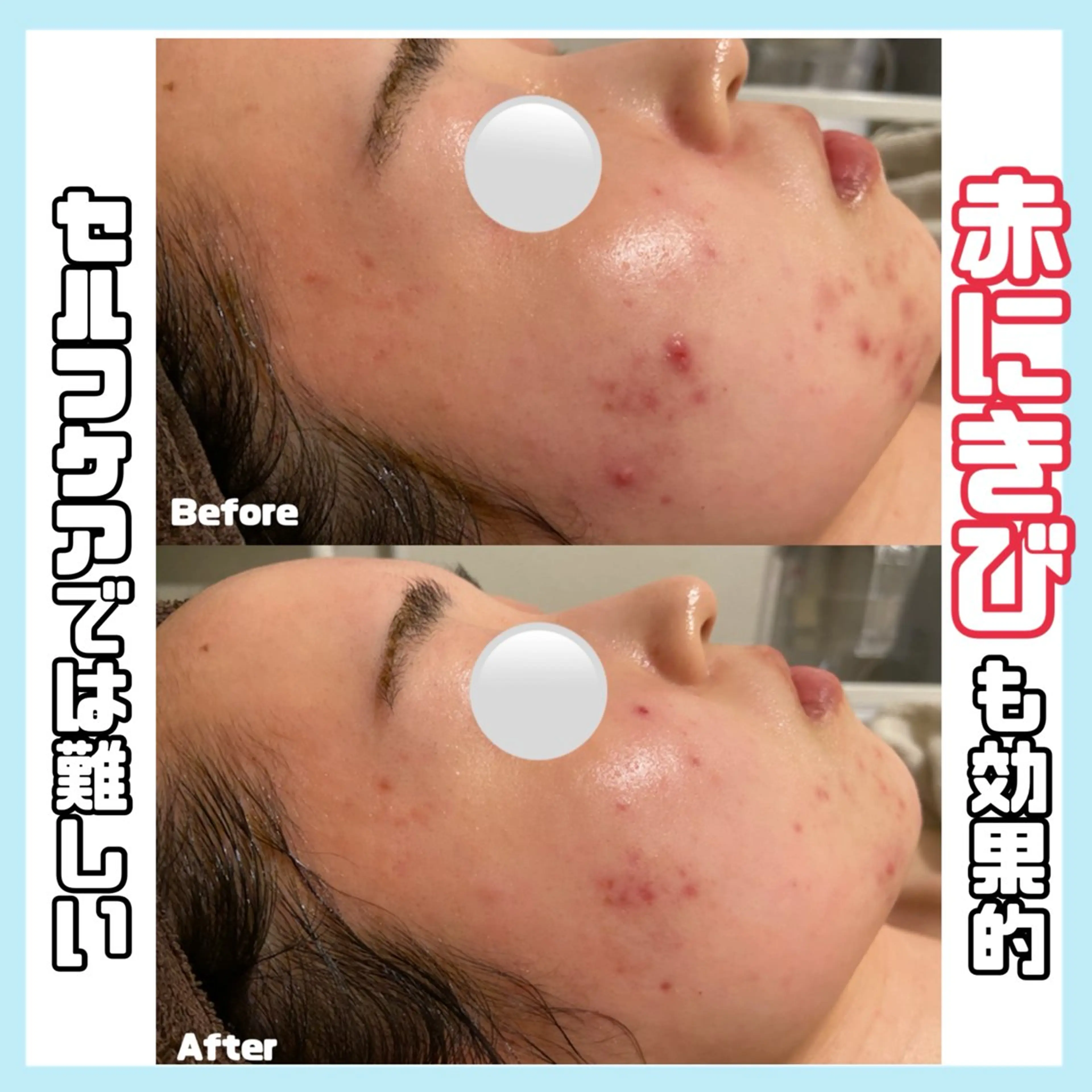 エステ オールハンド専門🤍 kasumiのエステ・リラクイメージ