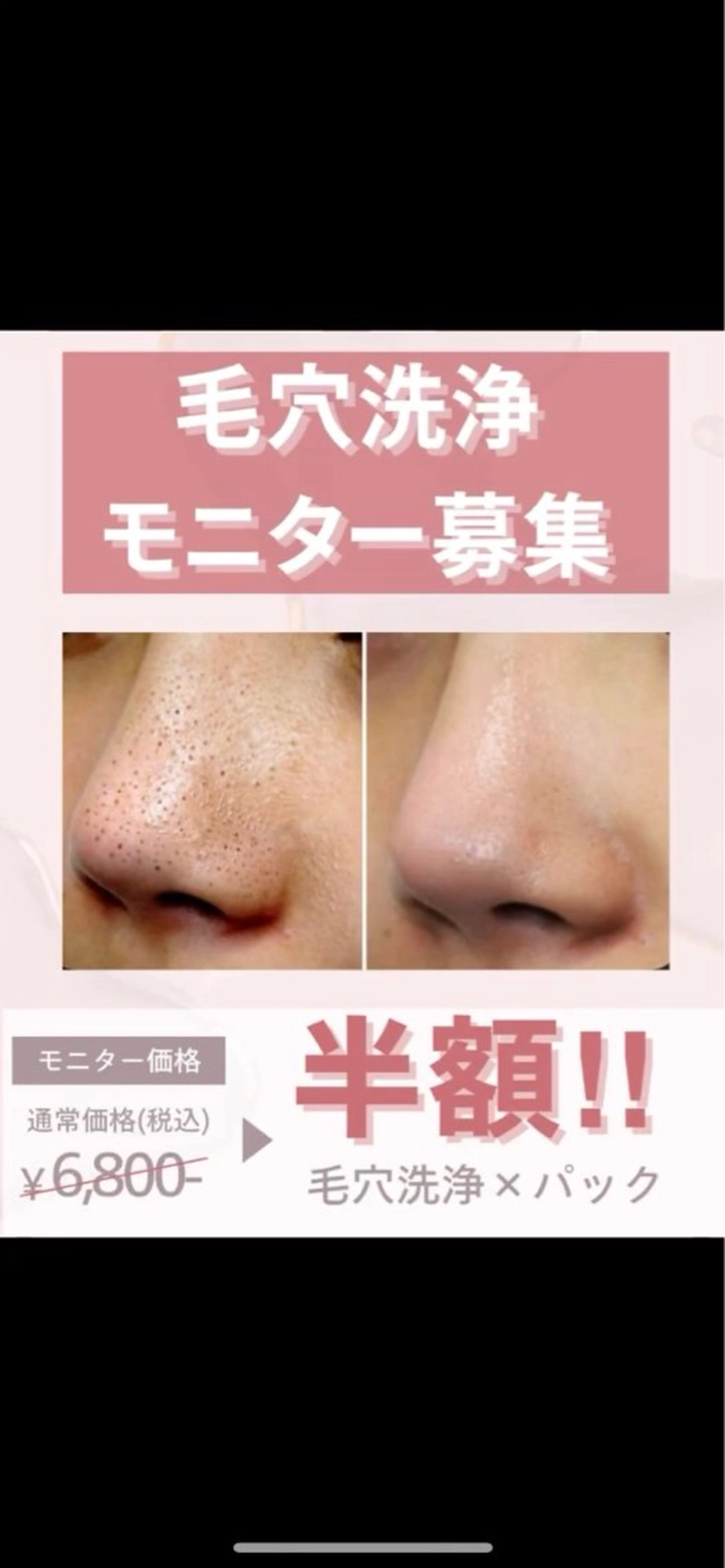 【毛穴洗浄】半額！モニター募集！パック付きの写真