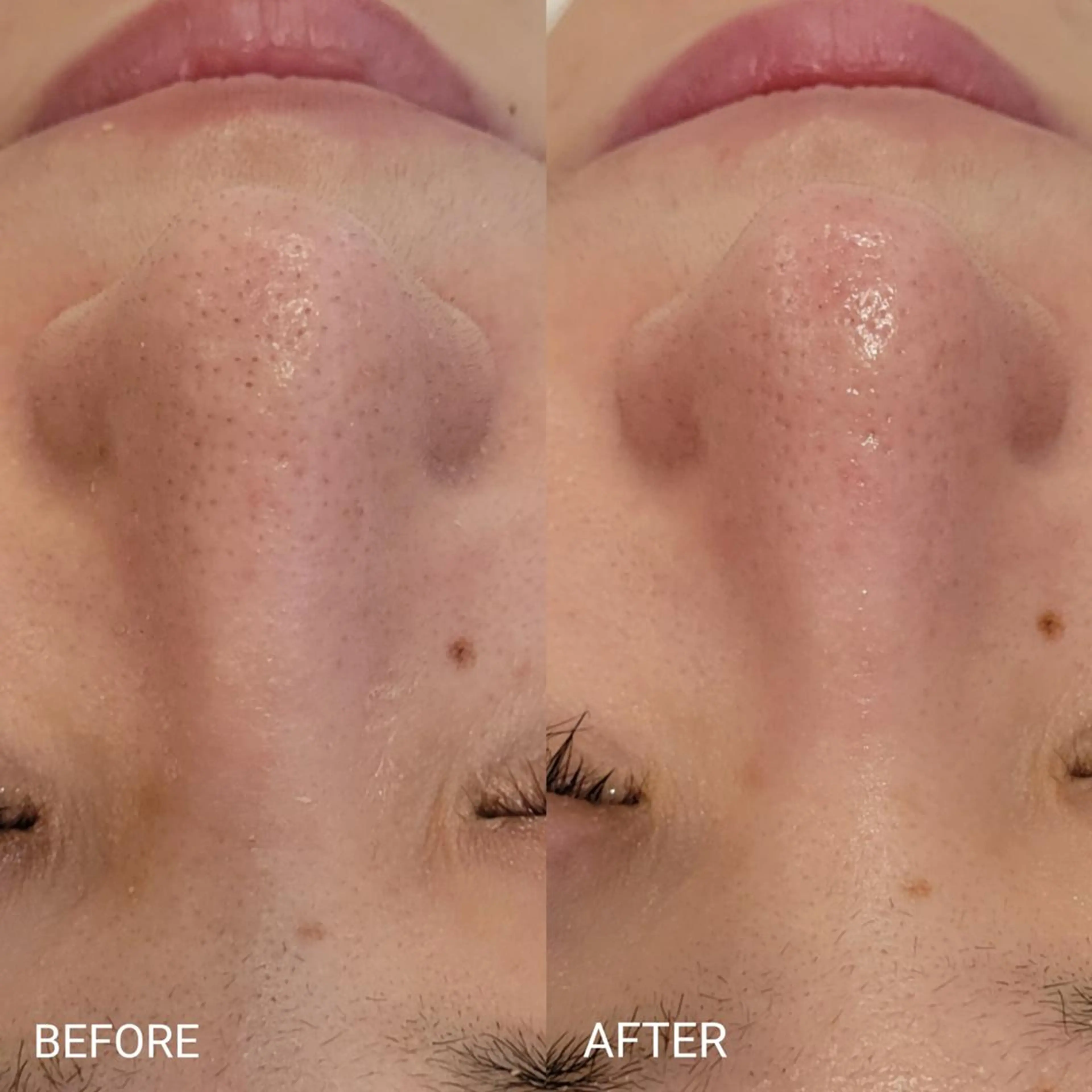 エステ リラク サロンドフララ 表参道店のエステ・リラクイメージ