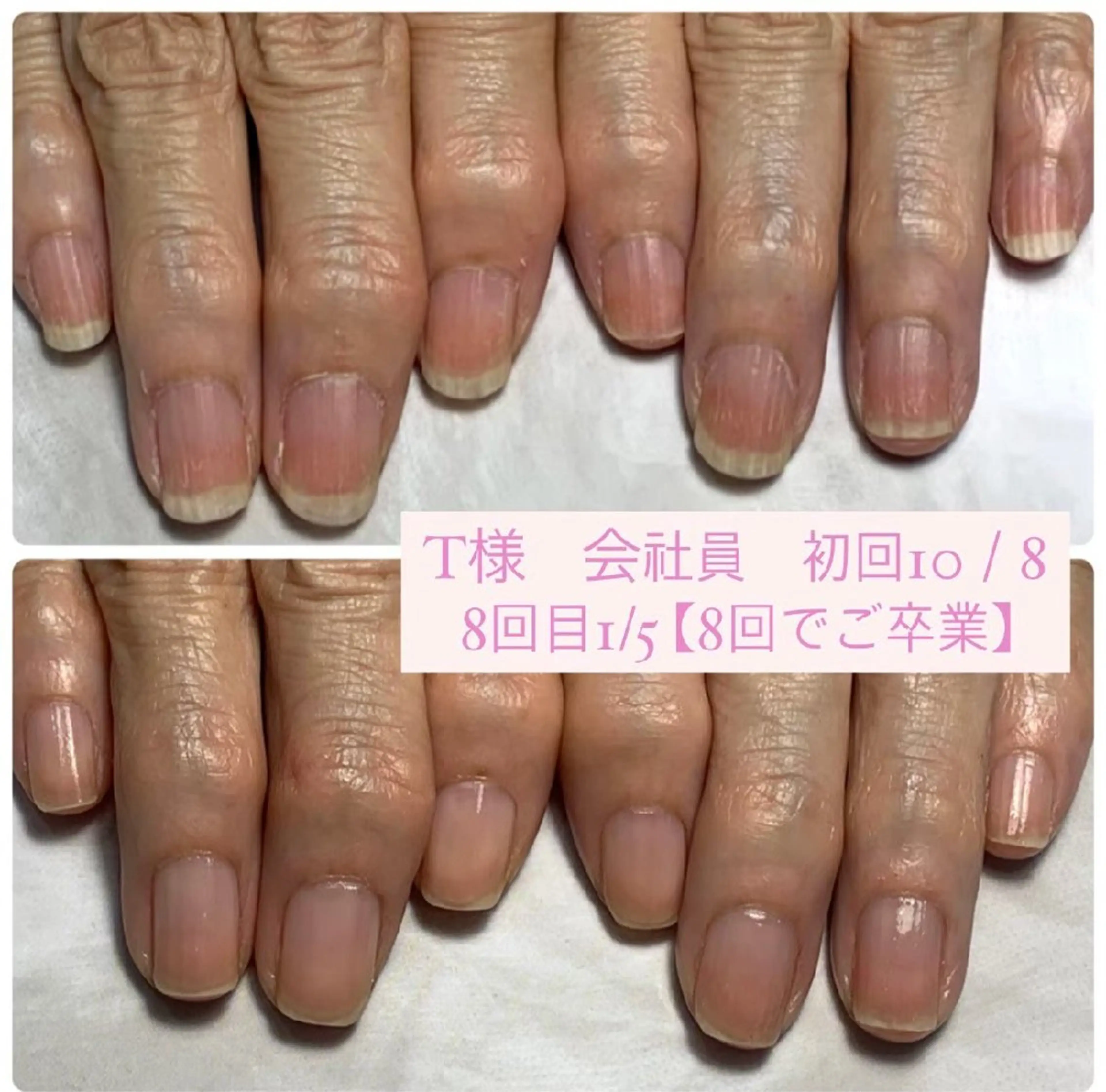 ネイル ジェルネイル ハンドケア AKT Beauty所属・AKT Beauty ドライヘッドスパのエステ・リラクイメージ