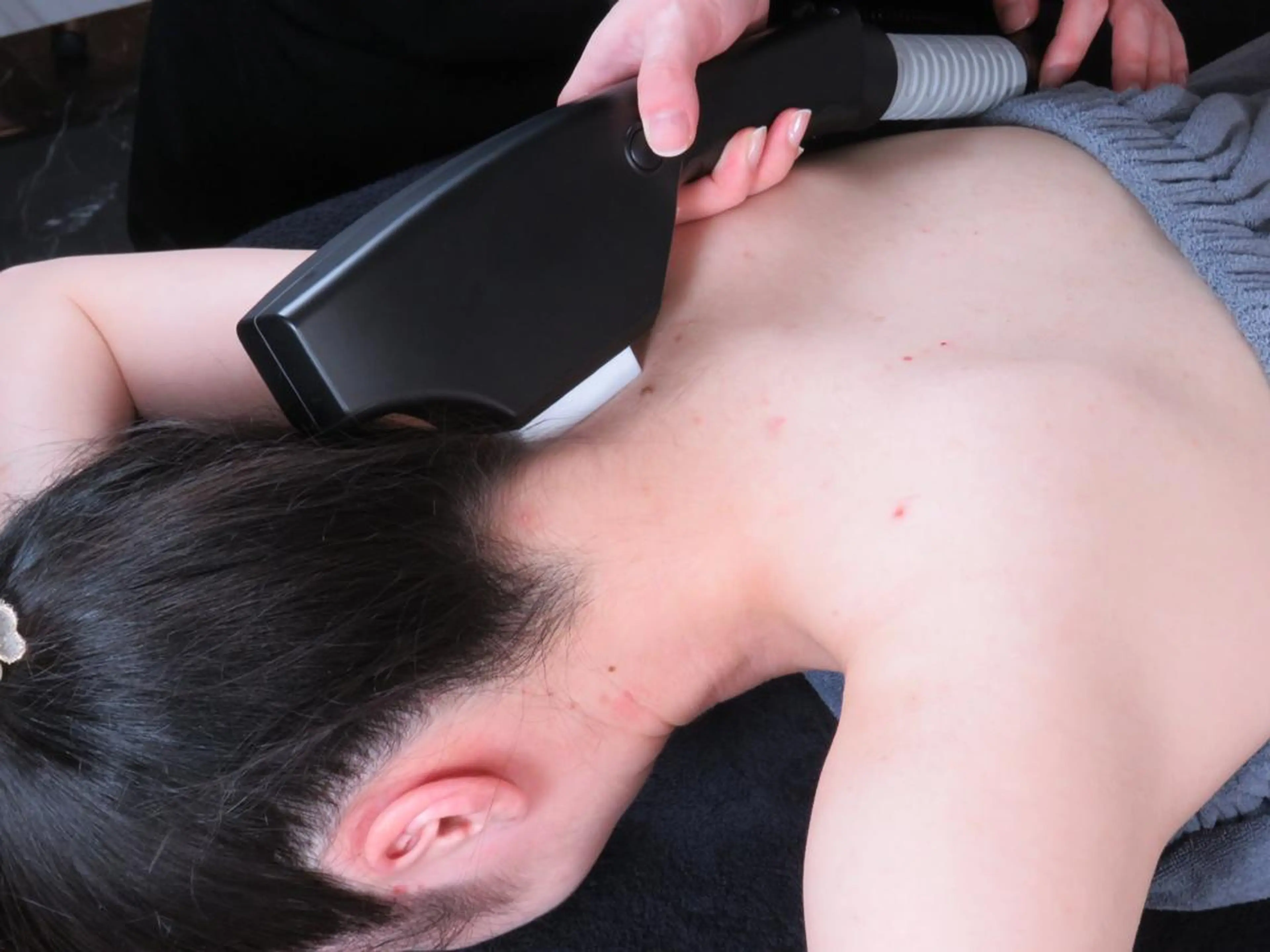 ハーブピーリング RAVIOS 森田のその他イメージ