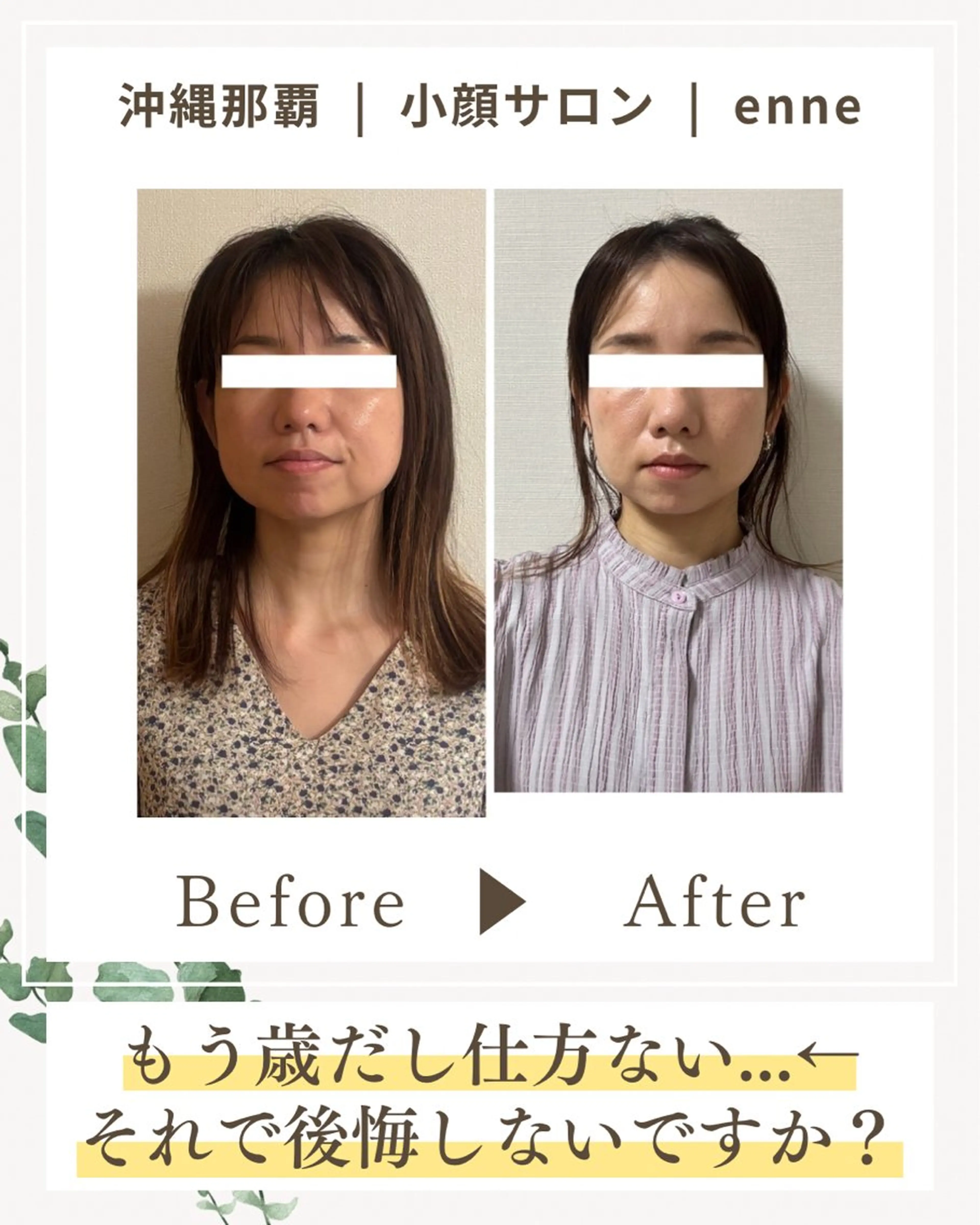 その他 小顔サロンenne所属・小顔サロンenne 【エンネ】のその他イメージ