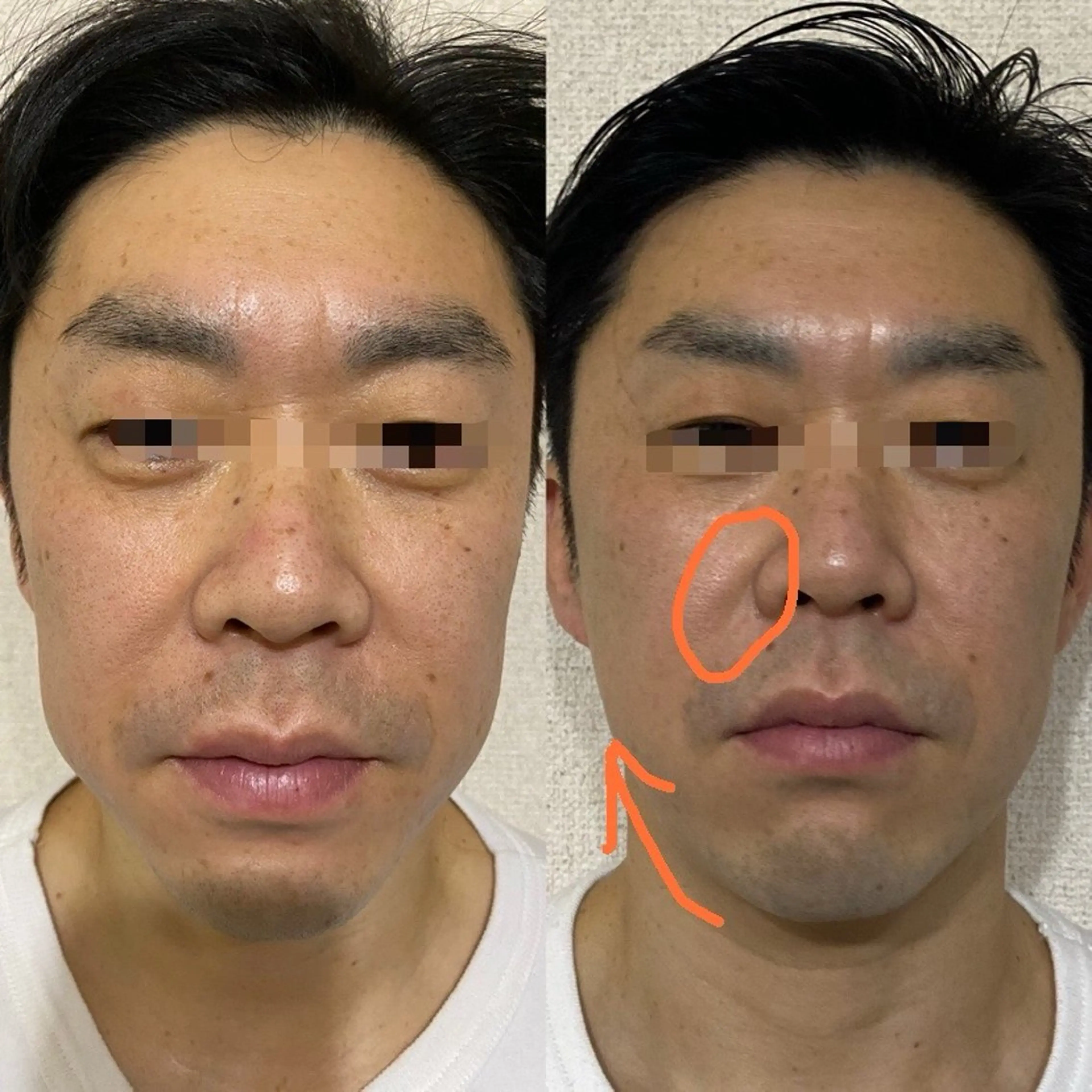 Meetite 小林のエステ・リラクイメージ