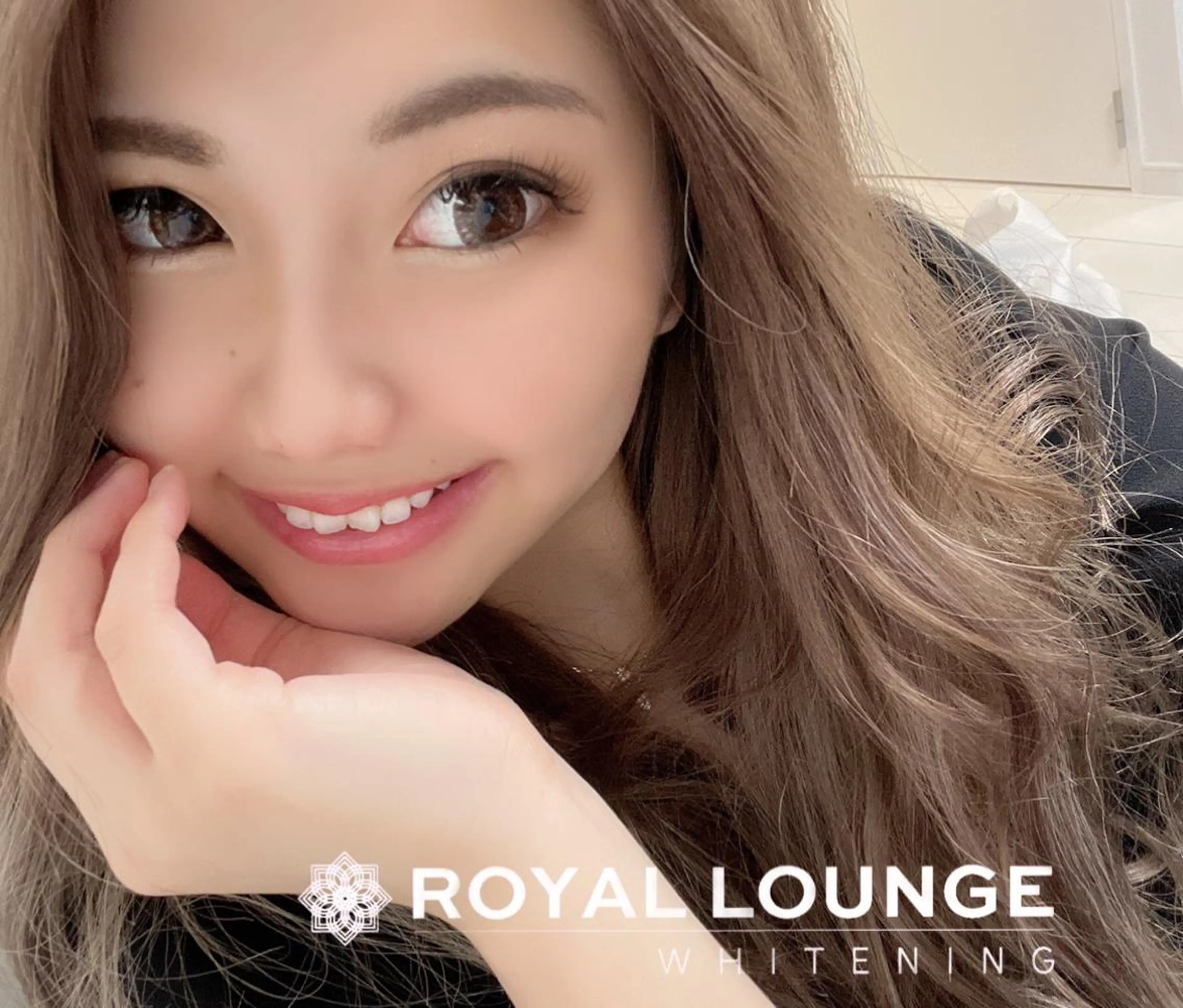 ✨ミニモ即決特別価格😍ホワイトニング（計12照射）10分3照射✖︎３来店＋メンテナンス3照射お家ケア歯磨き粉付き✨の写真