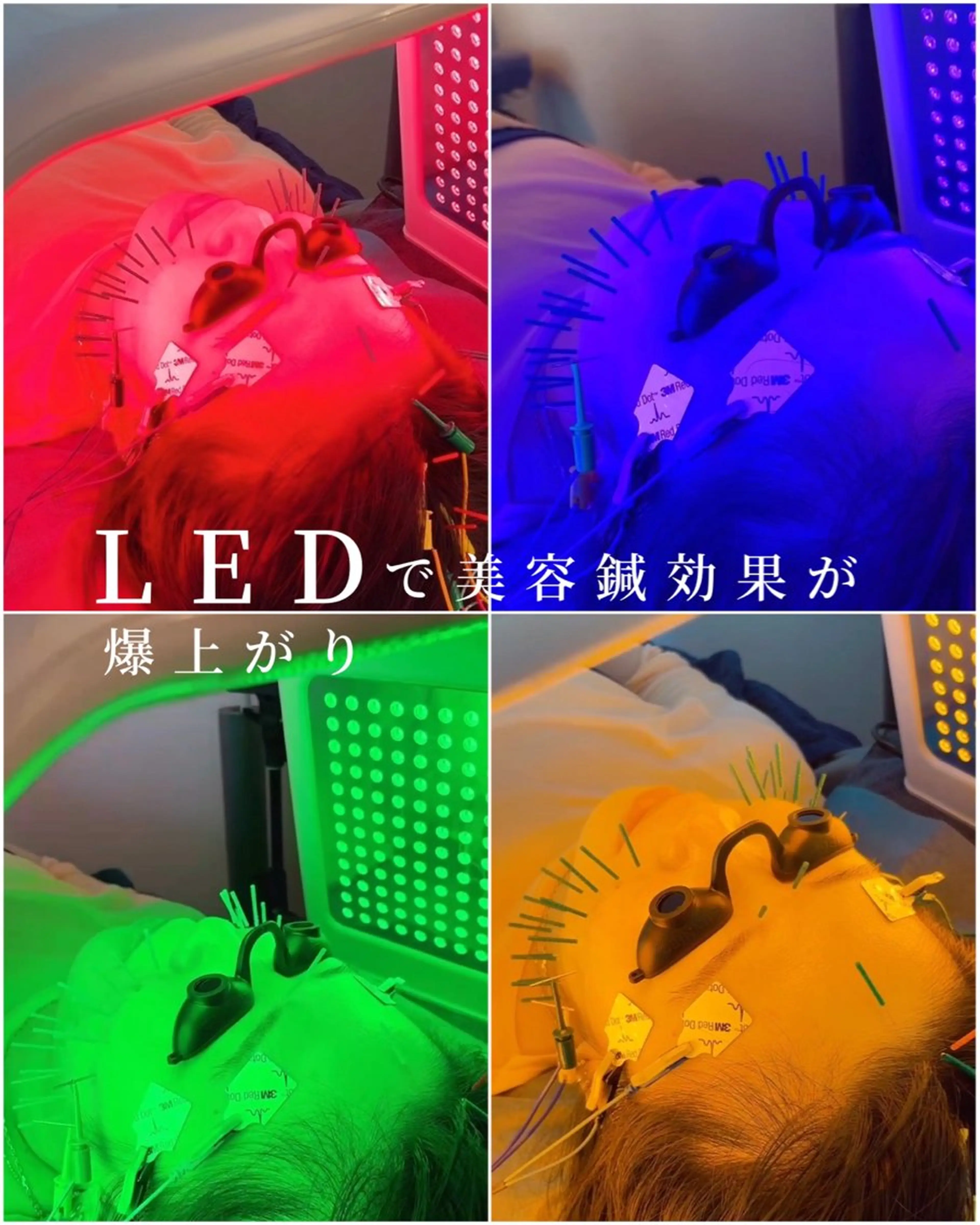 エステ リラク 小顔美容鍼専門サロン 渋谷YZのエステ・リラクイメージ