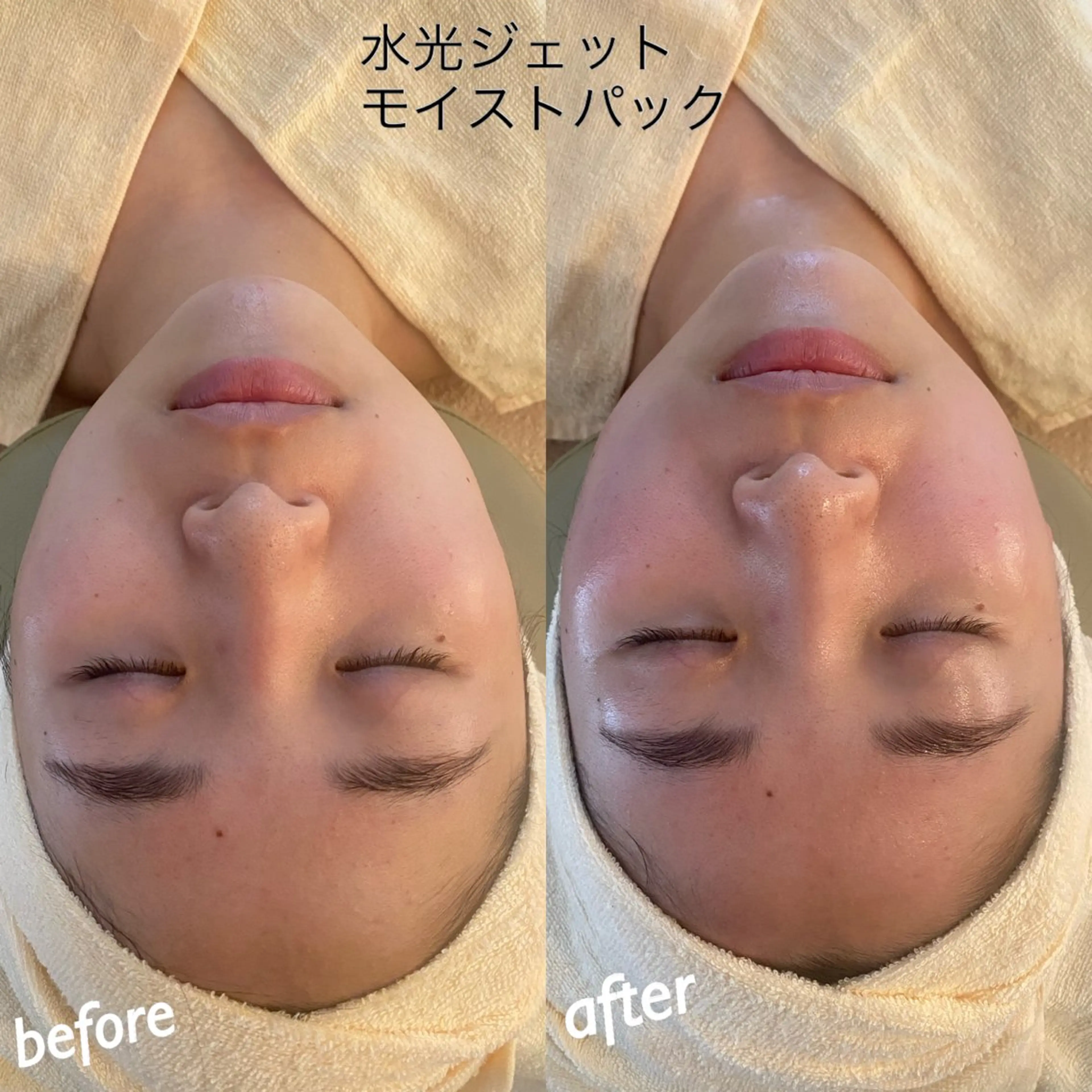 エステ うなじ脱毛/美肌脱毛 LABELのエステ・リラクイメージ