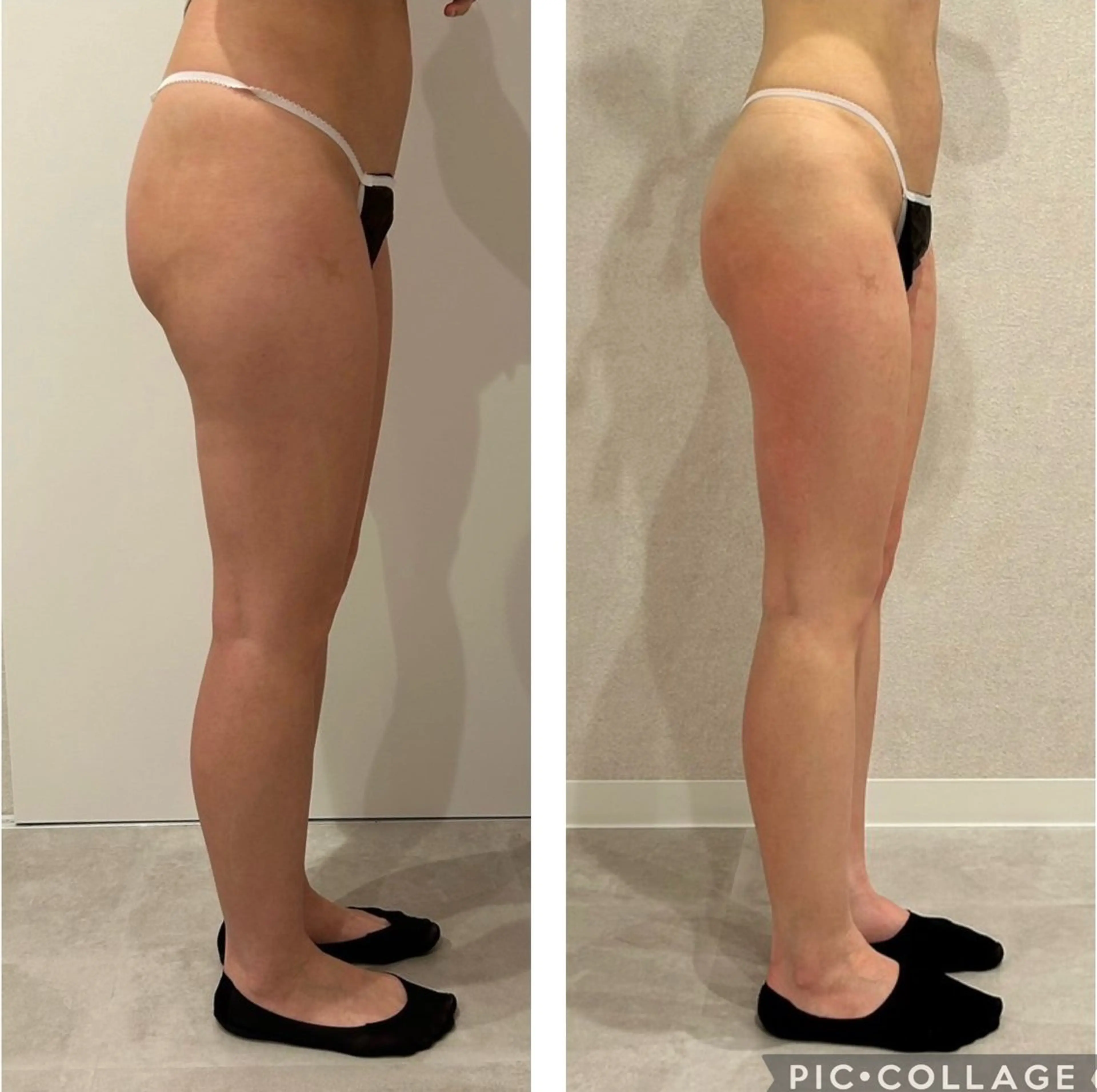 痩身✖️デトックス／60分の写真