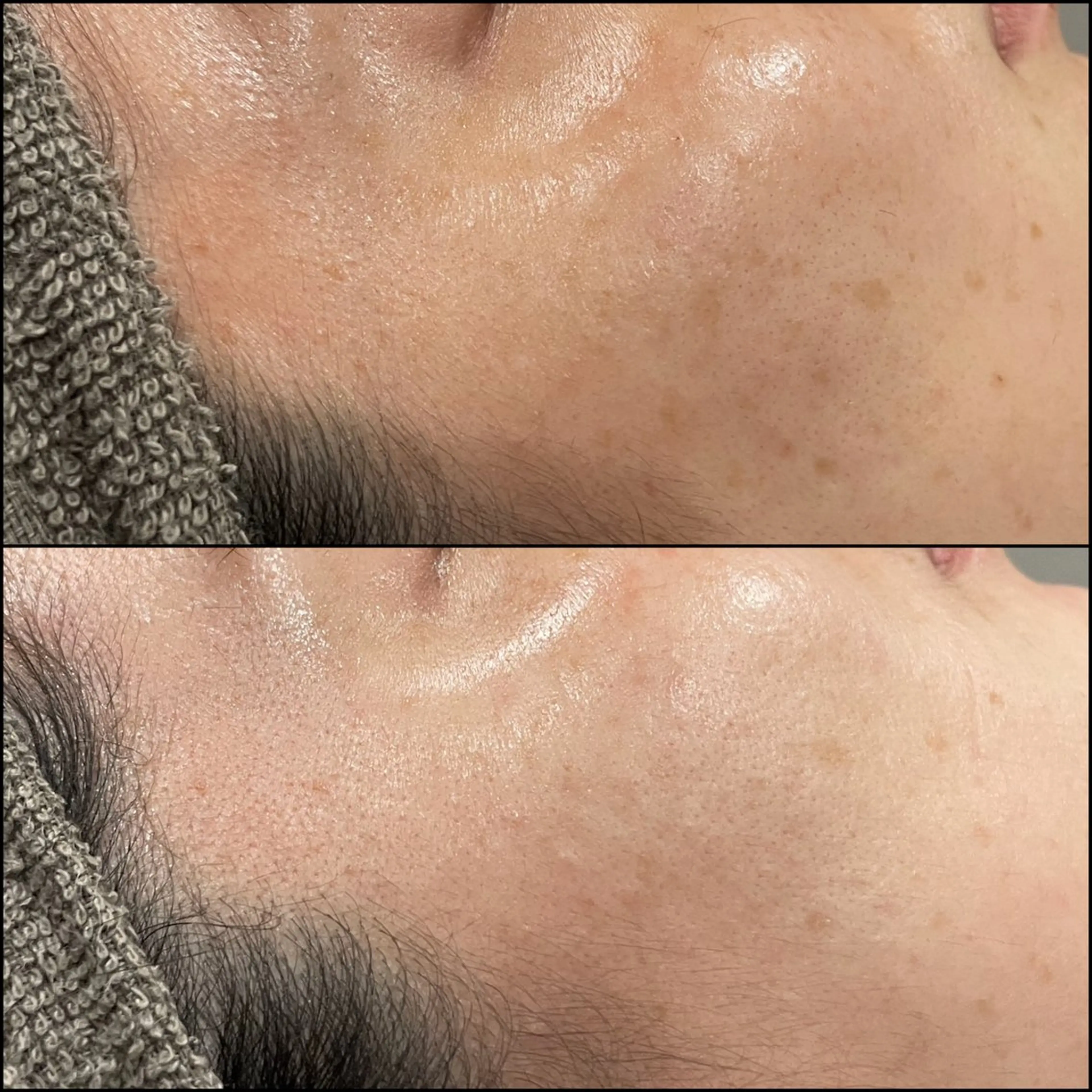 エステ LiZA エステティックサロンのエステ・リラクイメージ