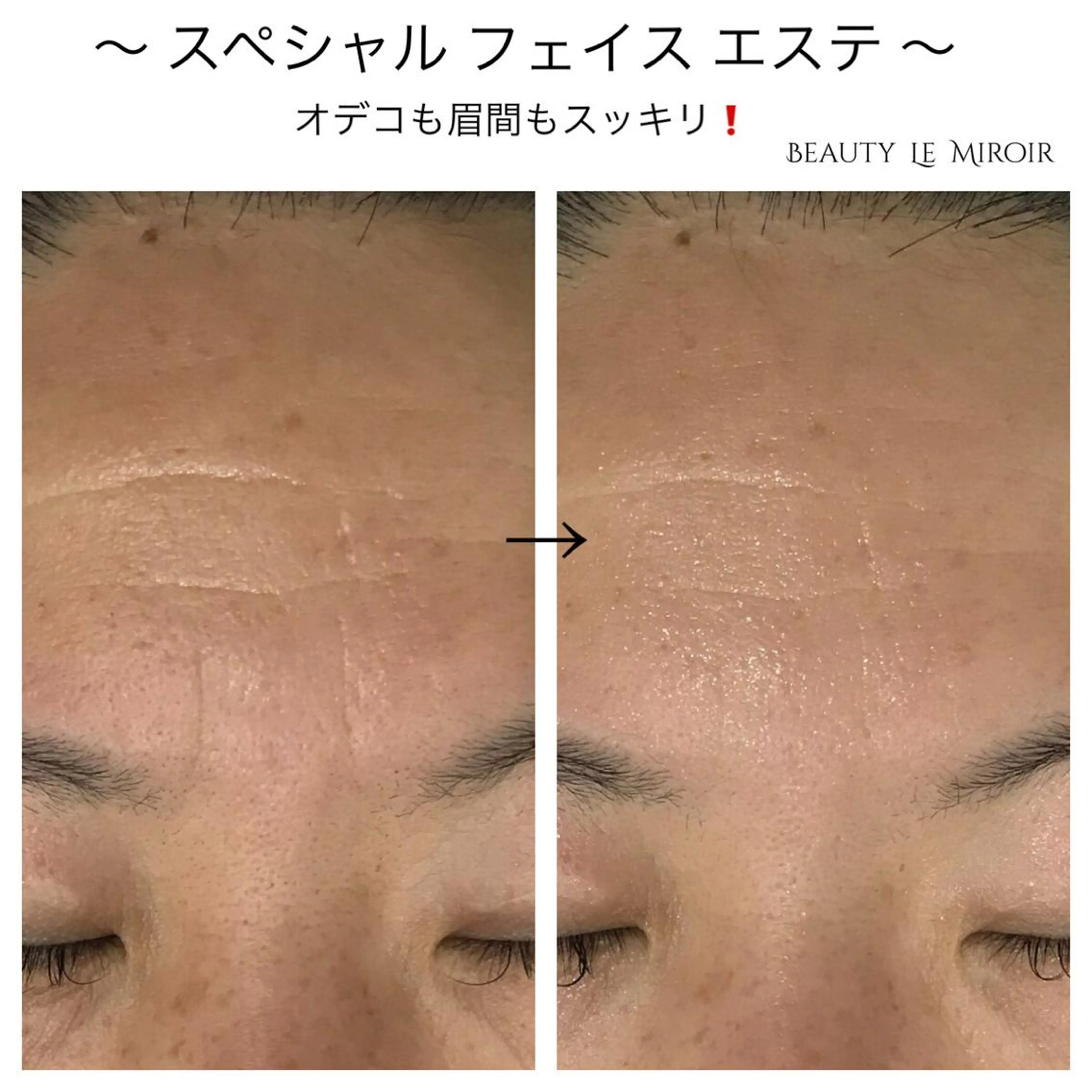 ビューティー ミロワールのエステ・リラクイメージ