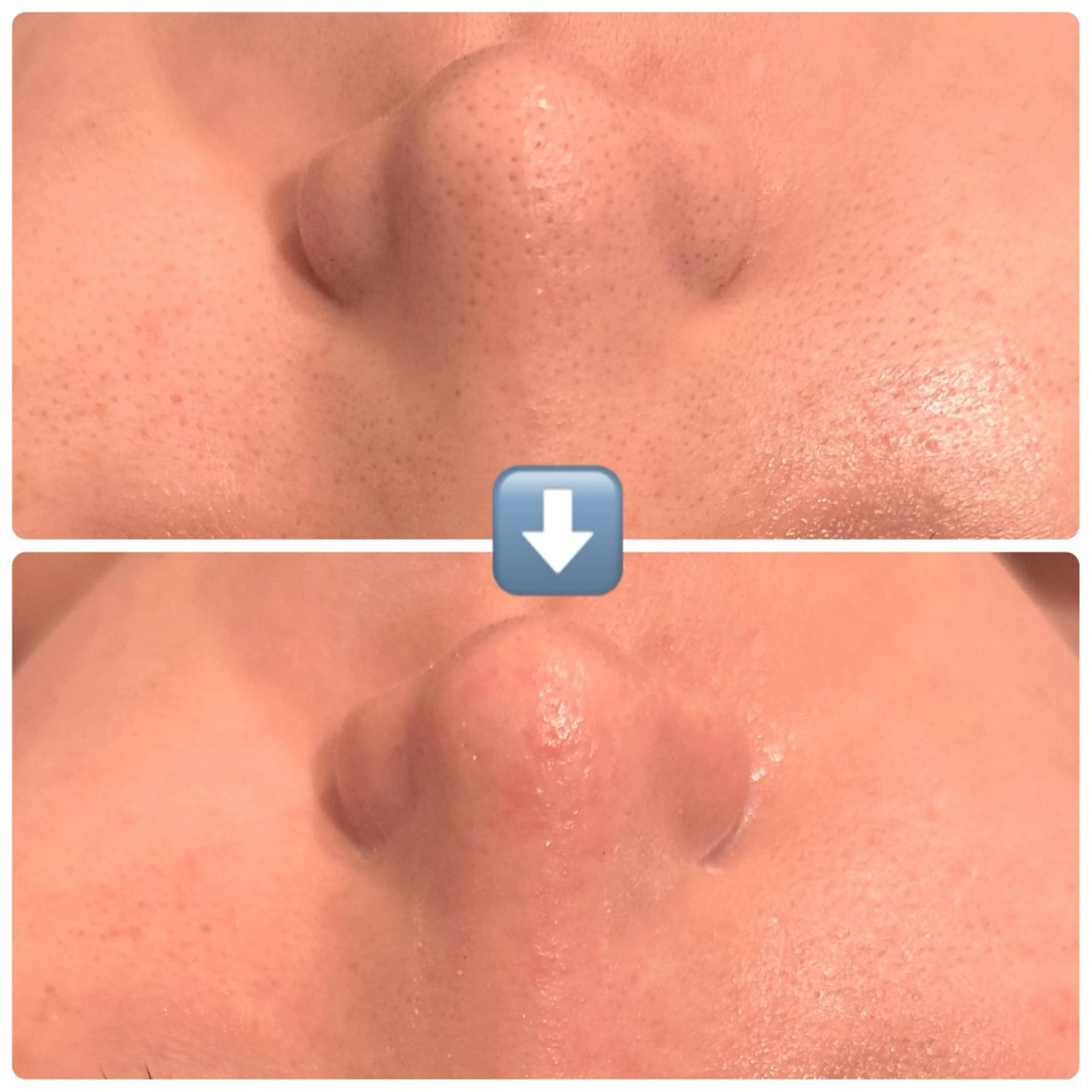 エステ 肌質改善sui所属・肌質改善 suiのエステ・リラクイメージ