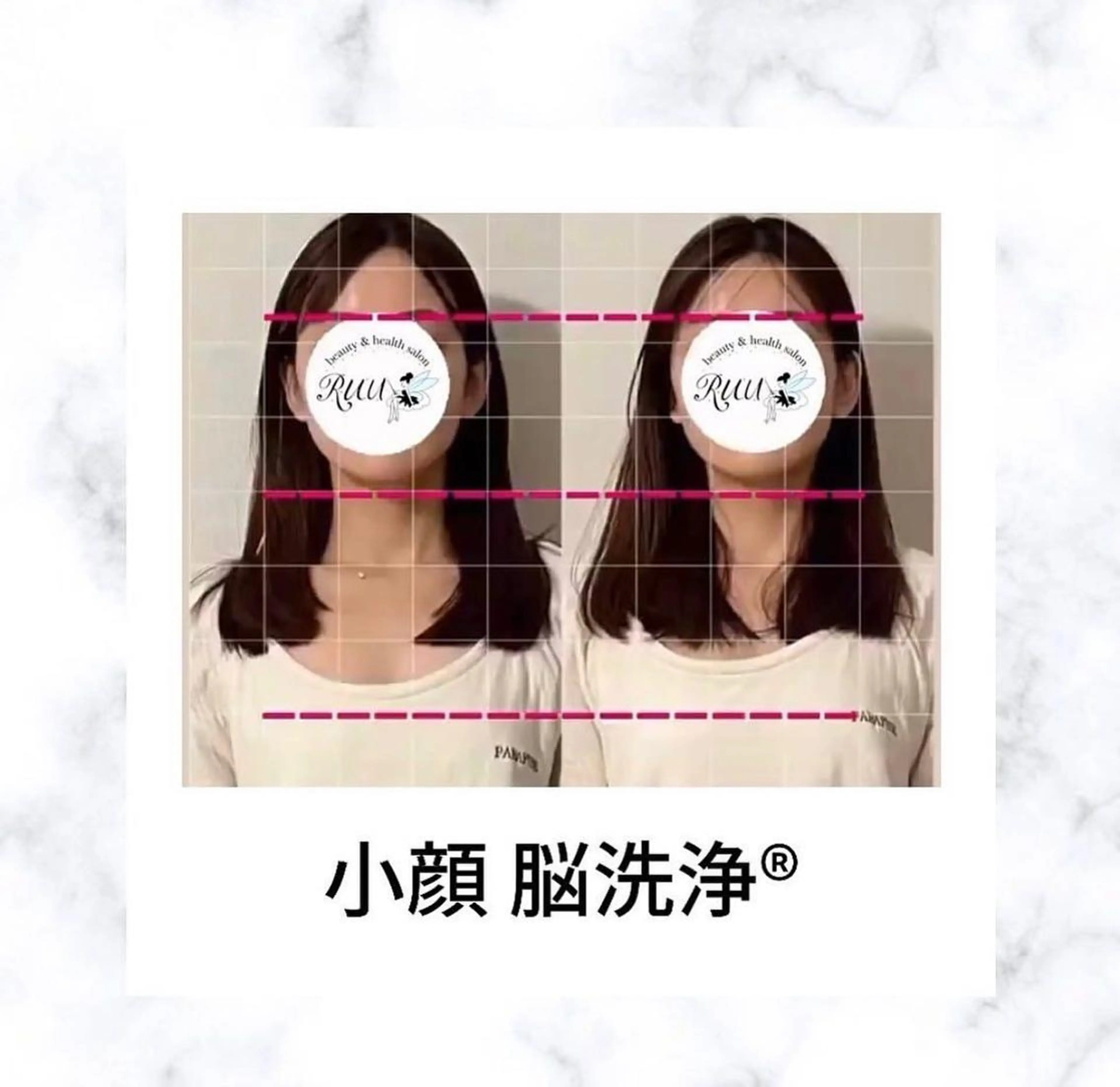 【頭痛、睡眠改善】 salon RUUのエステ・リラクイメージ