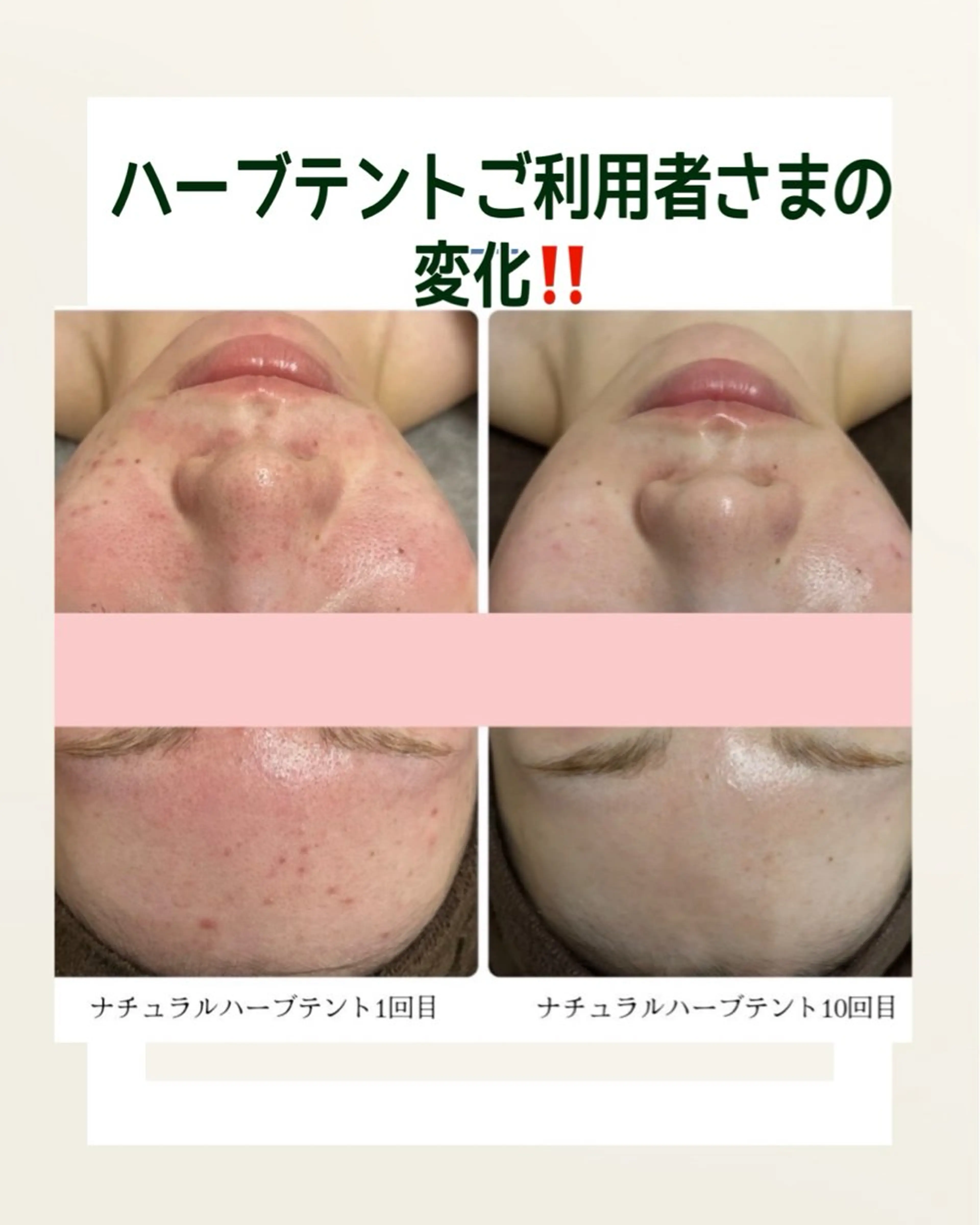 🍋レモンケーキ🍋所属・Lemon cakeのエステ・リラクイメージ