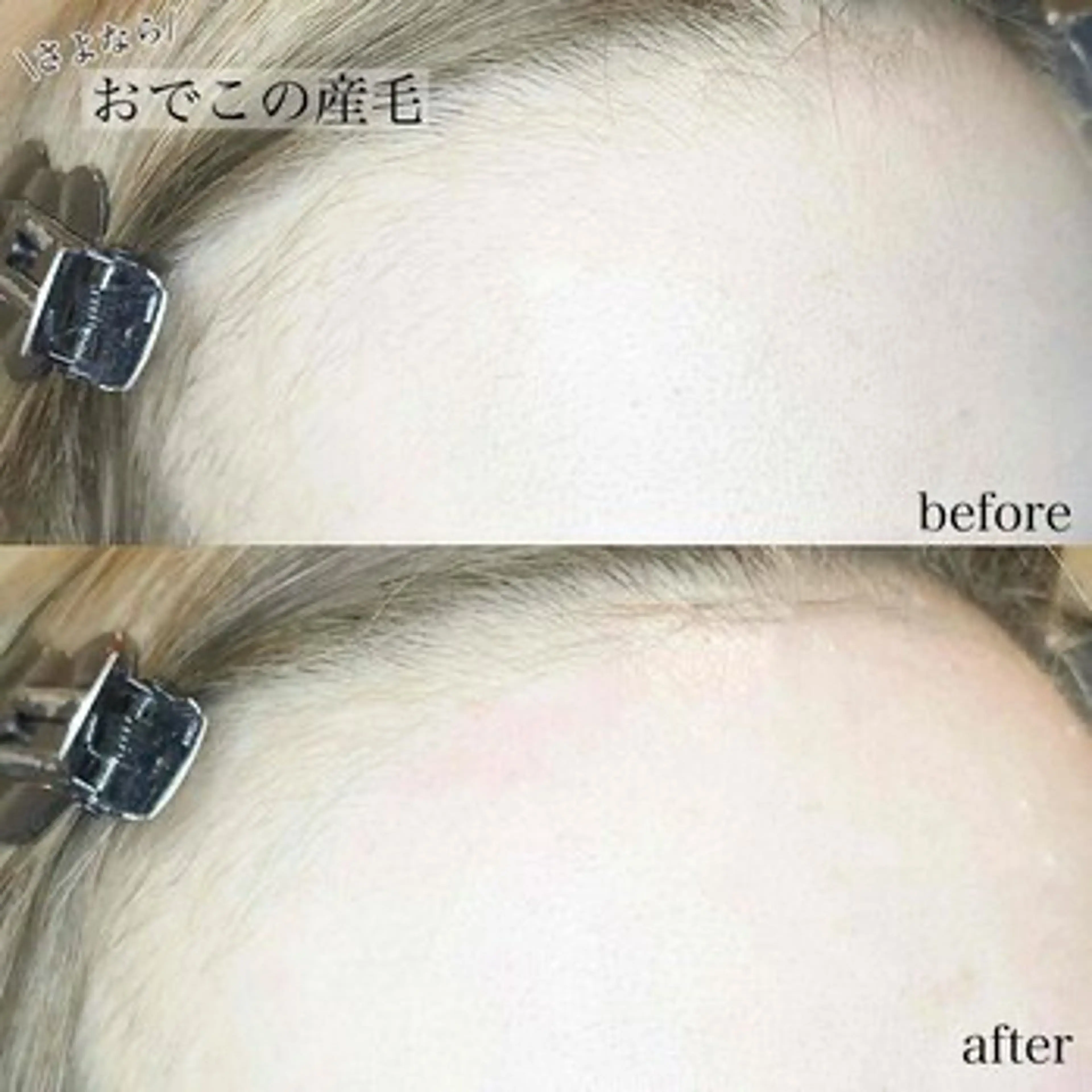 杉森 スギモリのマツエク・マツパデザイン