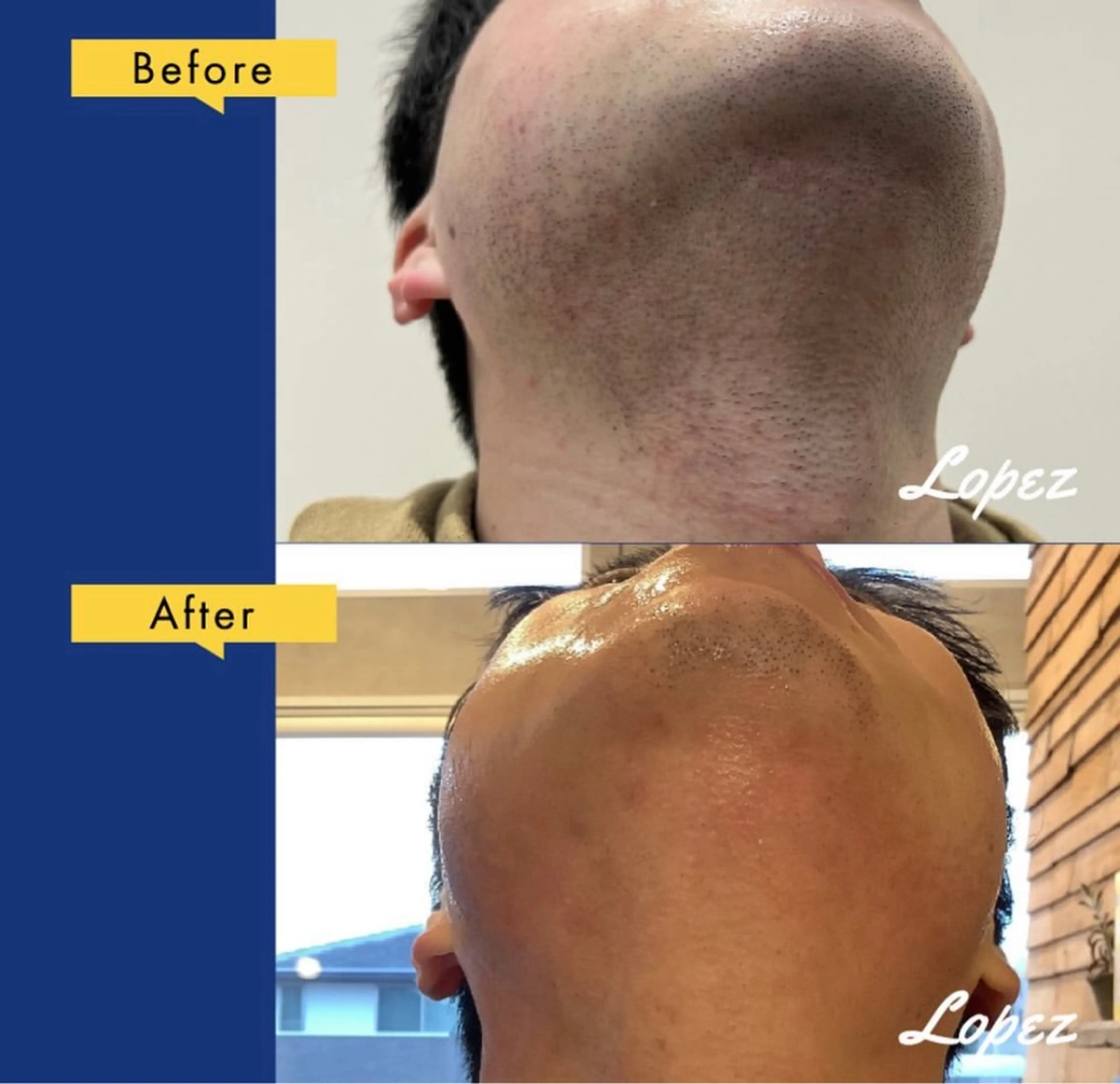 メンズ メンズ脱毛エステサロンロペス所属・小池 里穂のエステ・リラクイメージ