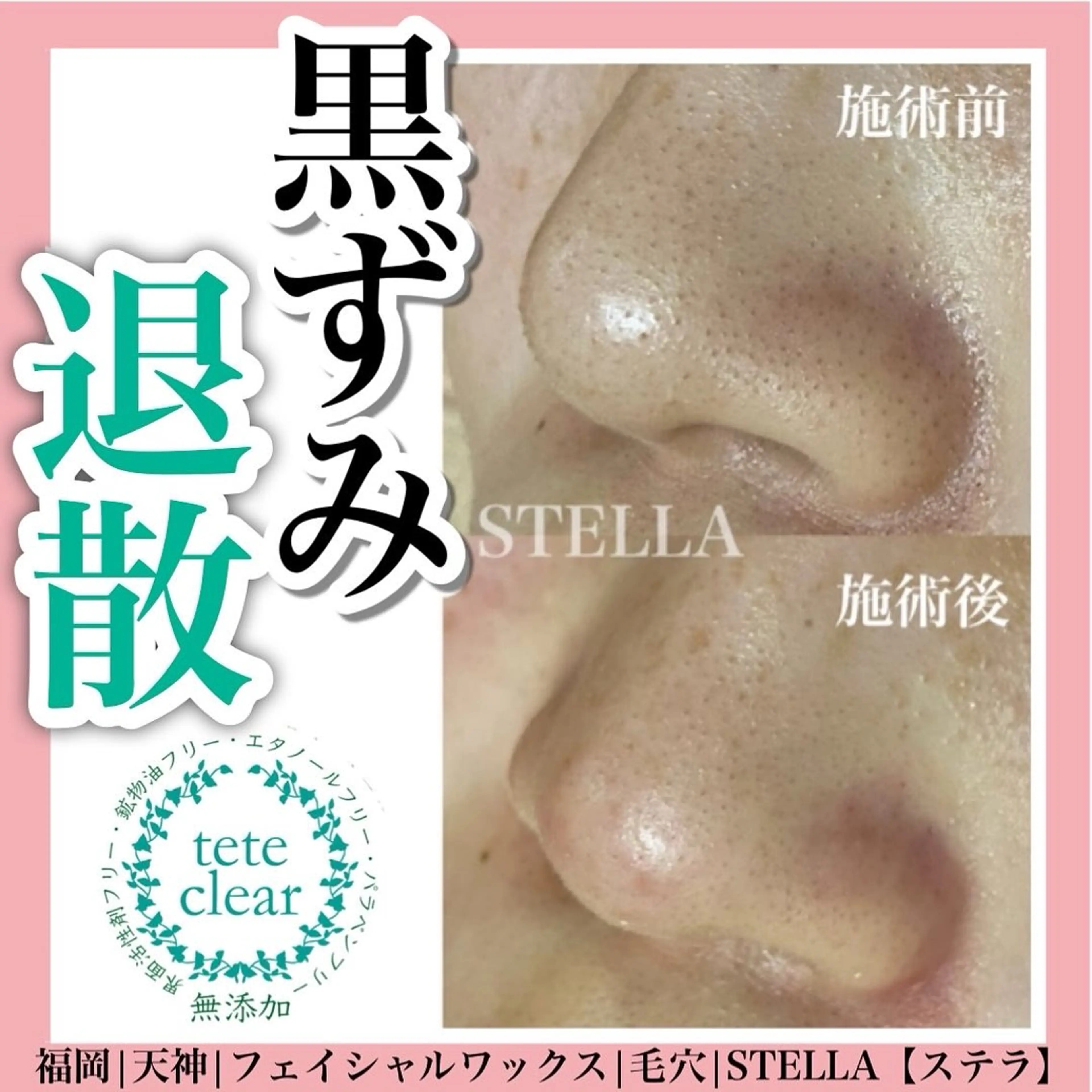 エステ ドライヘッドスパ＆ リンパ専門店　ステラのエステ・リラクイメージ