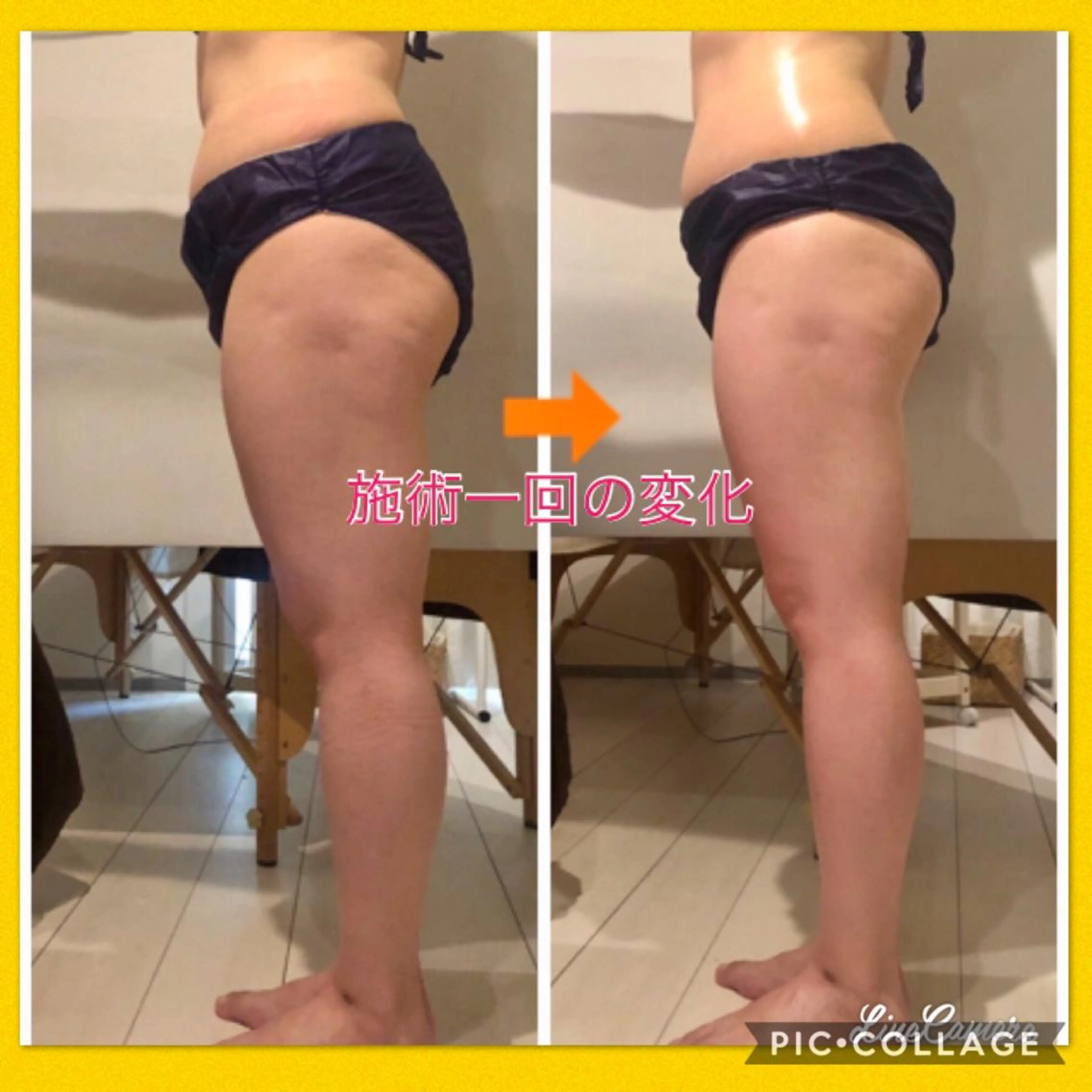 ショート カラー パーマ ヘアアレンジ メンズ キッズ ネイル マツエク・マツパ ‍痩身＆ボディ 結果出し🌟丹野のエステ・リラクイメージ