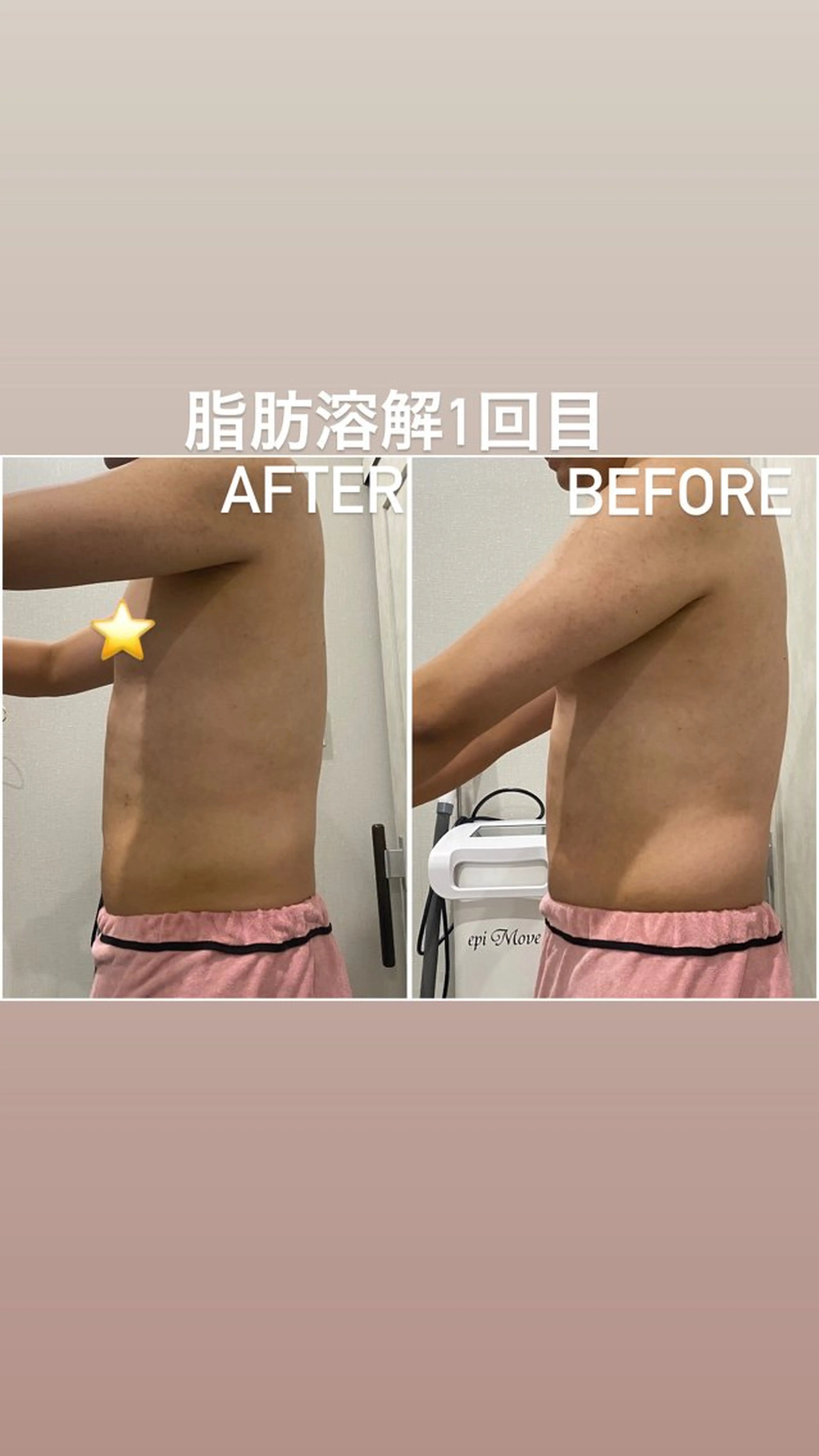 エステ アルカンジュ~archange~所属・痩身/毛穴洗浄/脱毛 アルカンジュのエステ・リラクイメージ