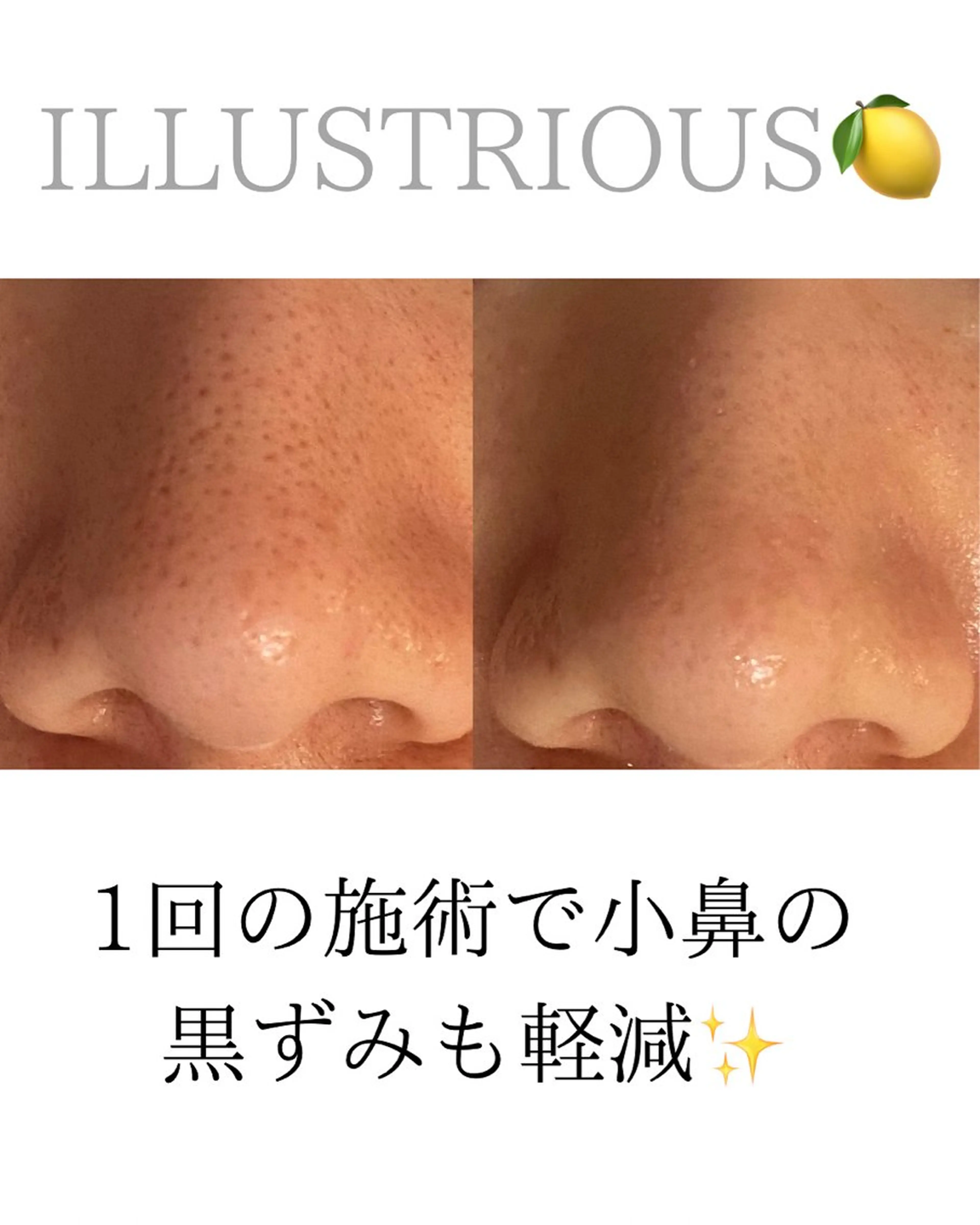 エステ リラク 田中For..天王寺 肌質改善/よもぎ蒸しのエステ・リラクイメージ