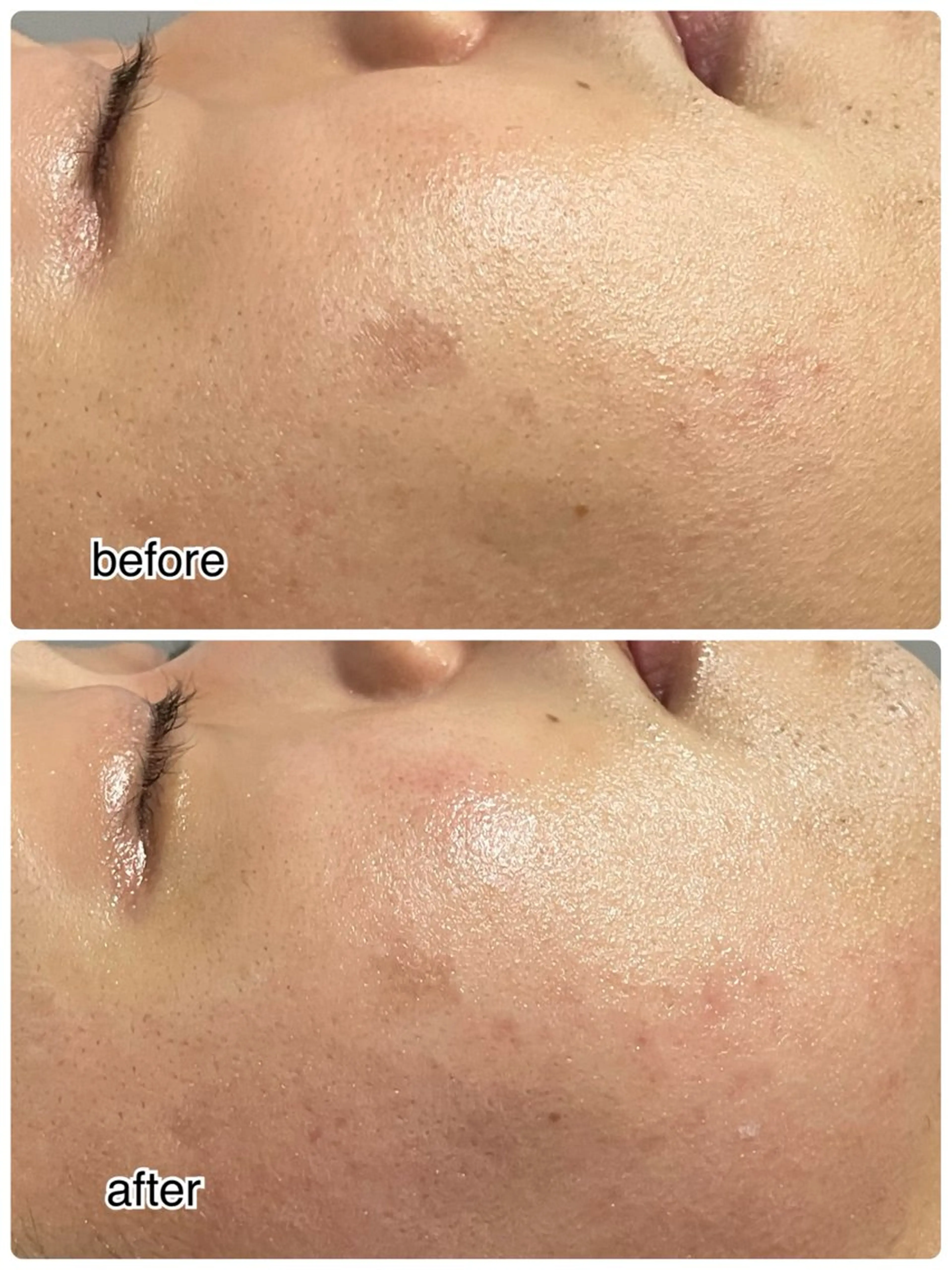 その他 ENCHANT 脱毛.小顔.毛穴のエステ・リラクイメージ