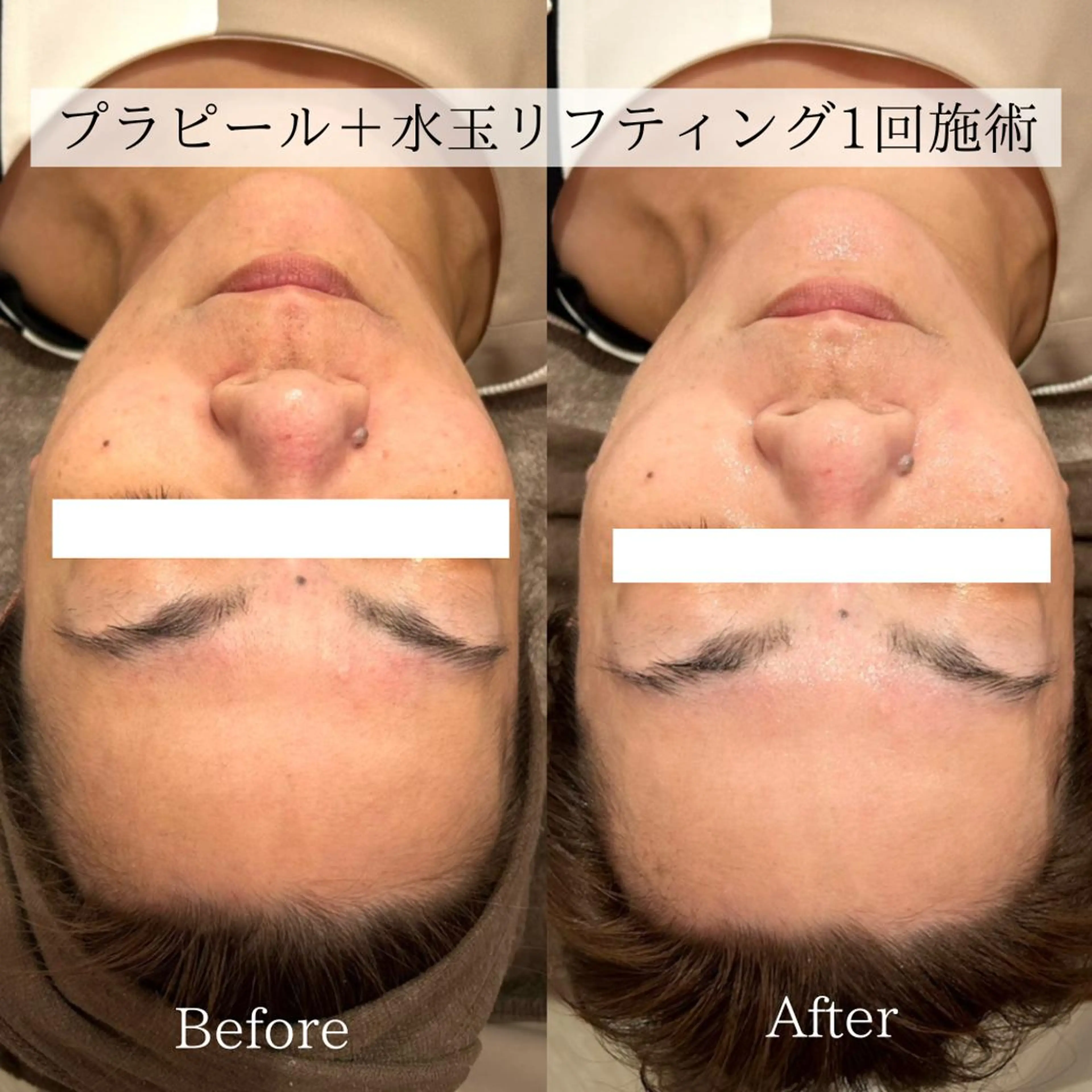 エステ 小顔美肌：ミアンカ 京阪モール本館1Fのエステ・リラクイメージ