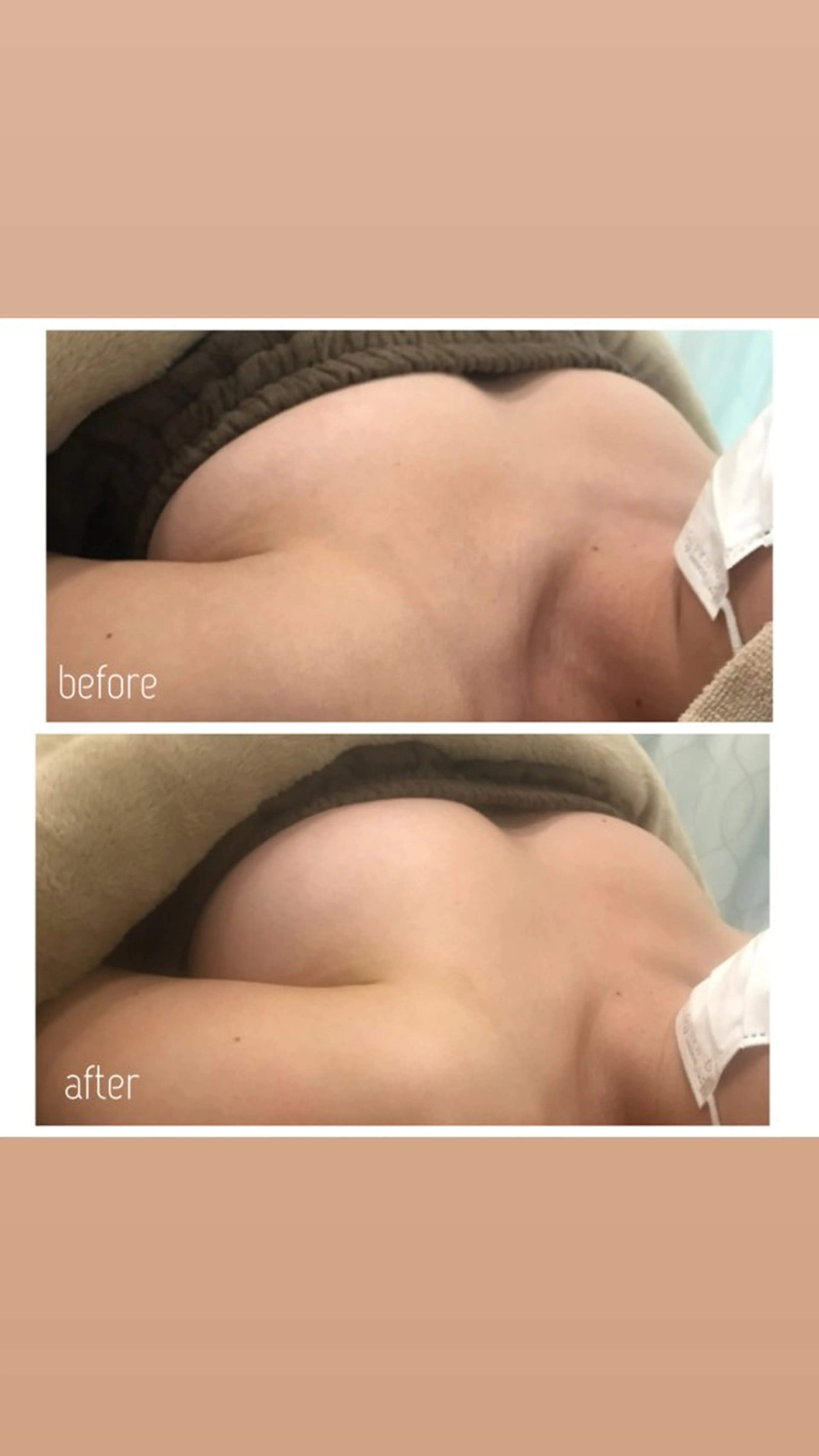 Rene 慢性疲労ケアサロンのエステ・リラクイメージ