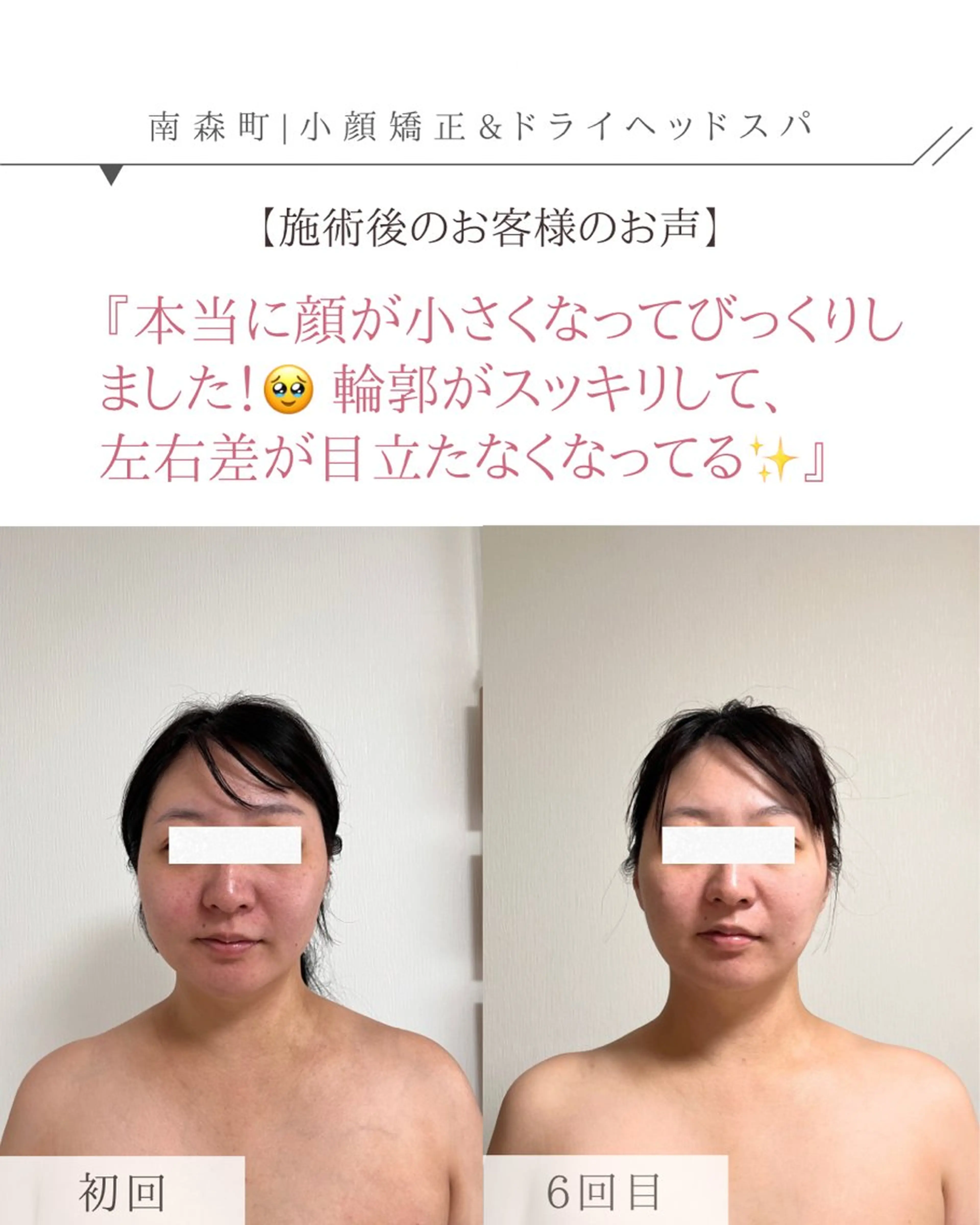 ドライヘッドスパ専門店 SIESTA所属・ドライヘッドスパ 専門店SIESTAのエステ・リラクイメージ