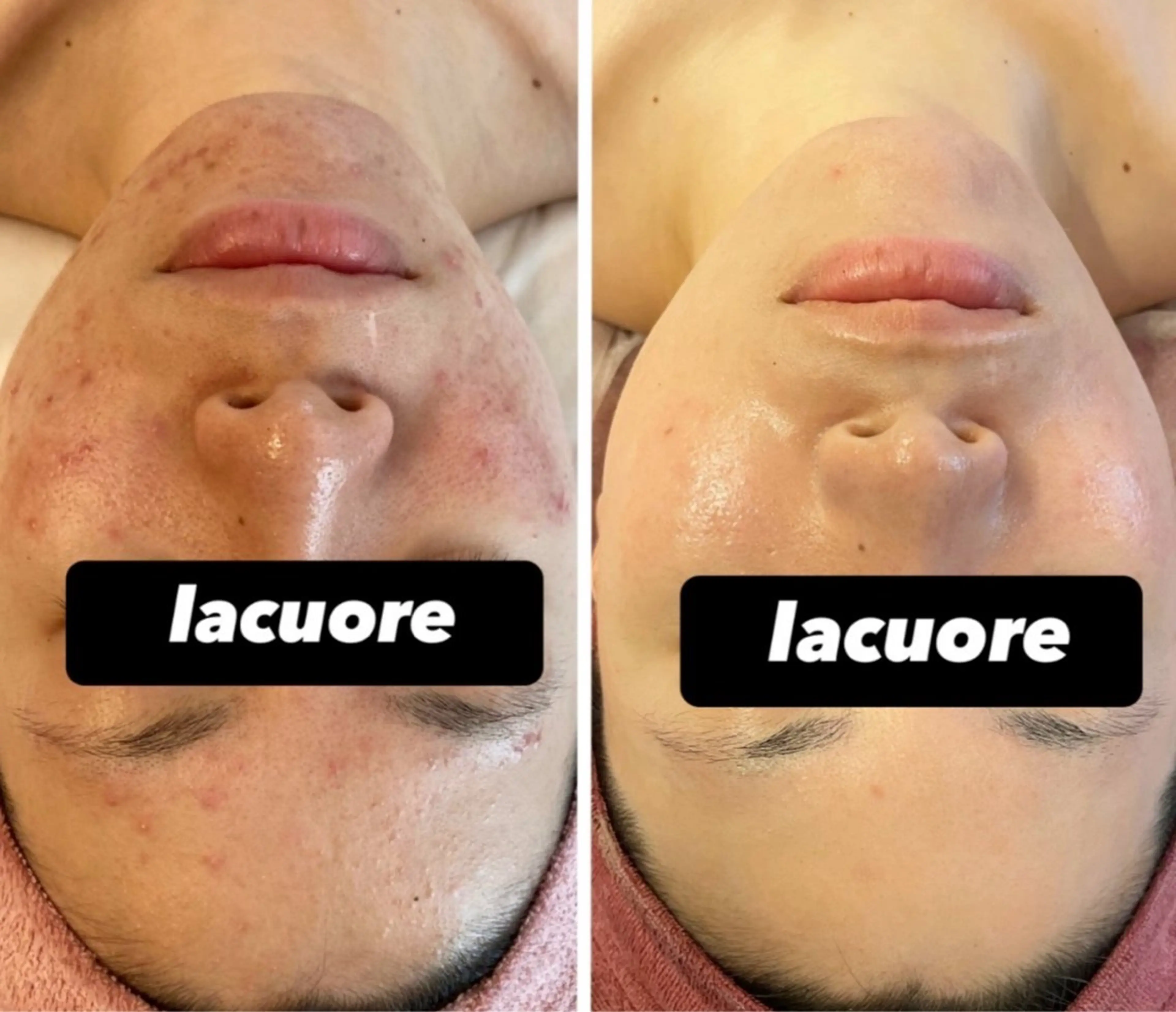 la   cuore所属・la   cuore 🌹ラ クオーレ🌹のエステ・リラクイメージ