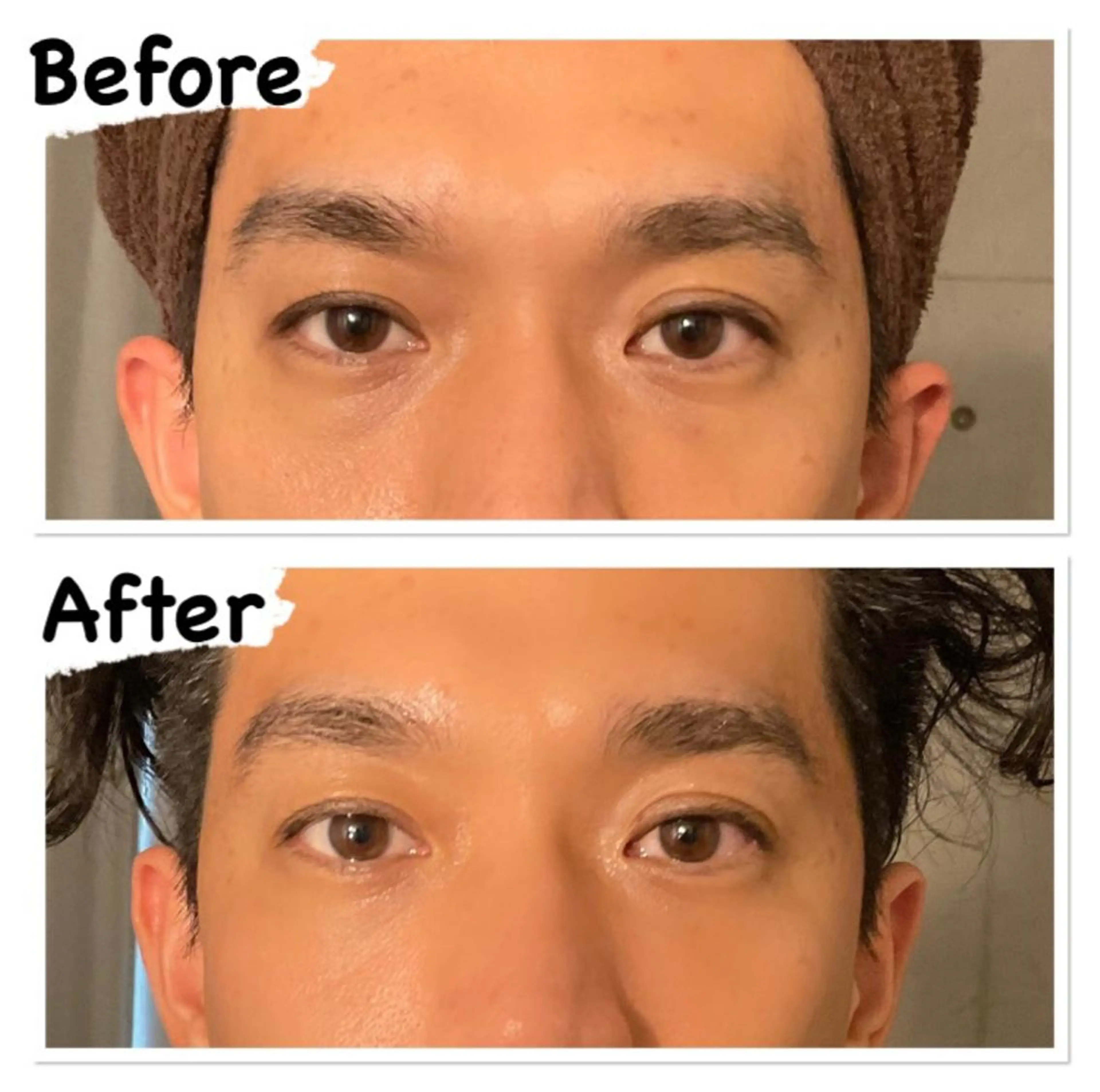 ✨週末限定クーポン✨目元クマケア＋上半身ボディケアの写真