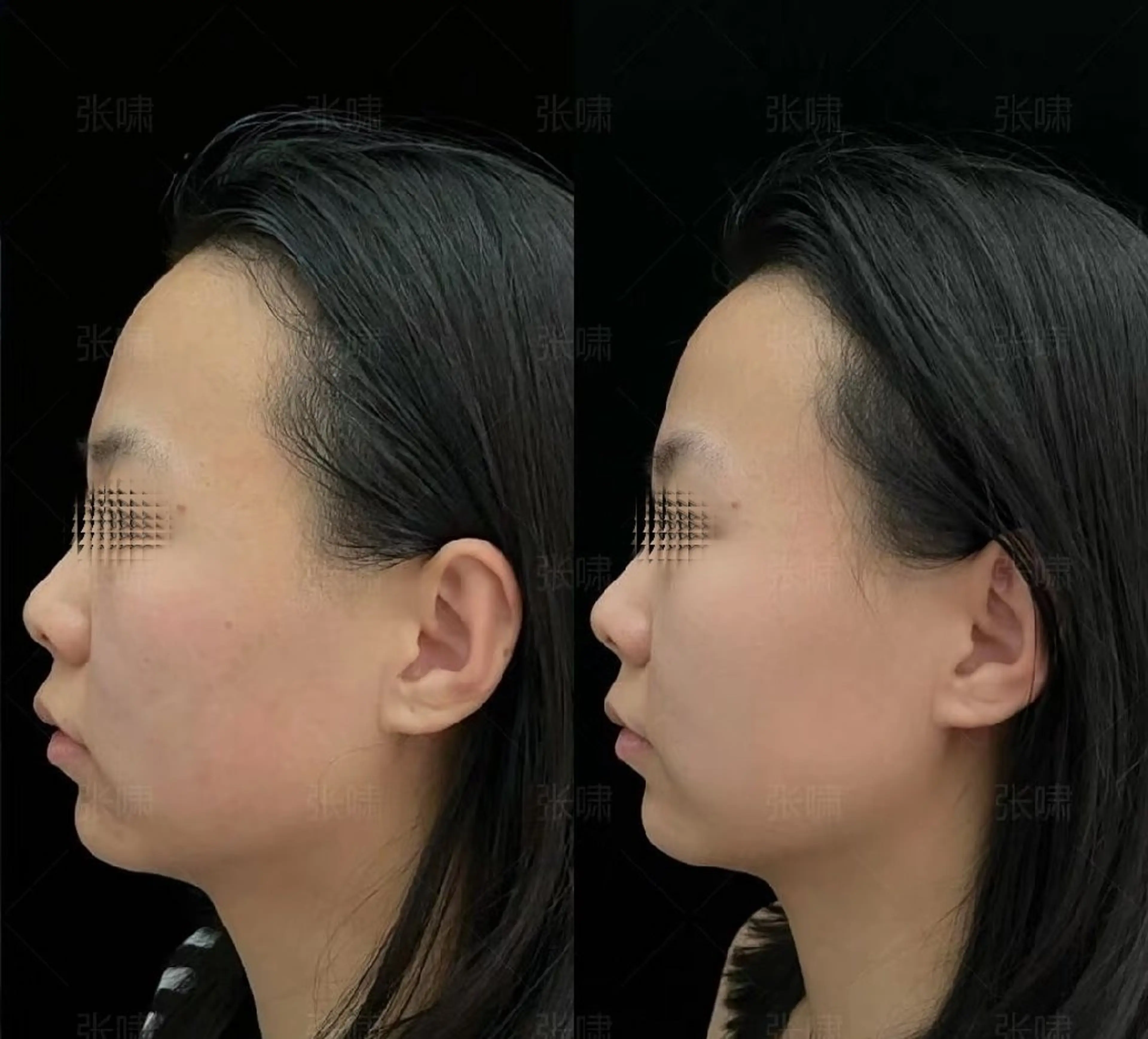 マツエク・マツパ 結婚式・ブライダル aliaハイフ&水光ジェットサロン所属・aliaハーブ水光店 エステティシャン募集のエステ・リラクイメージ