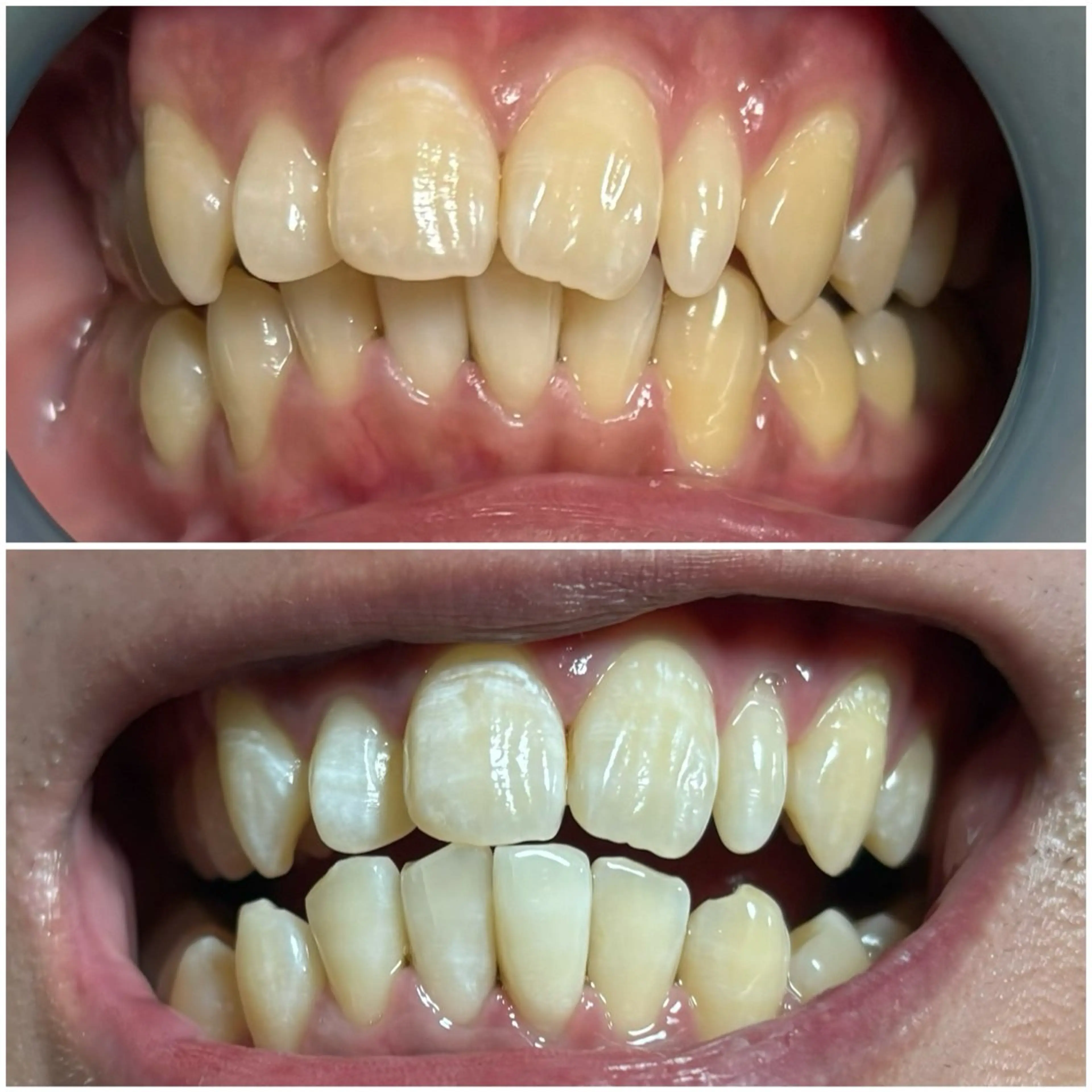 トータルサロン Re`ZAltの眉毛・アイブロウイメージ