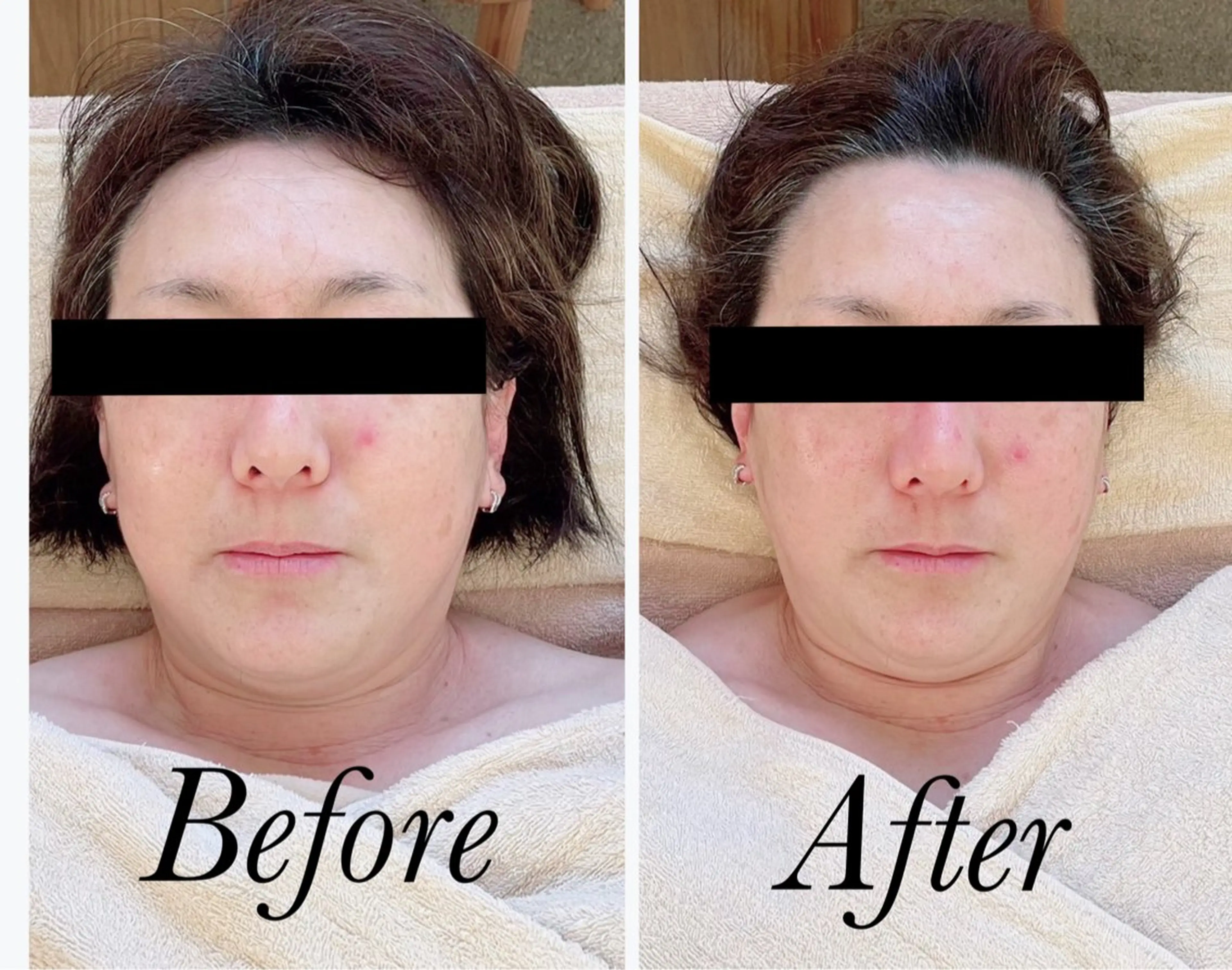 小顔矯正専門 町田   /鈴木友実のエステ・リラクイメージ