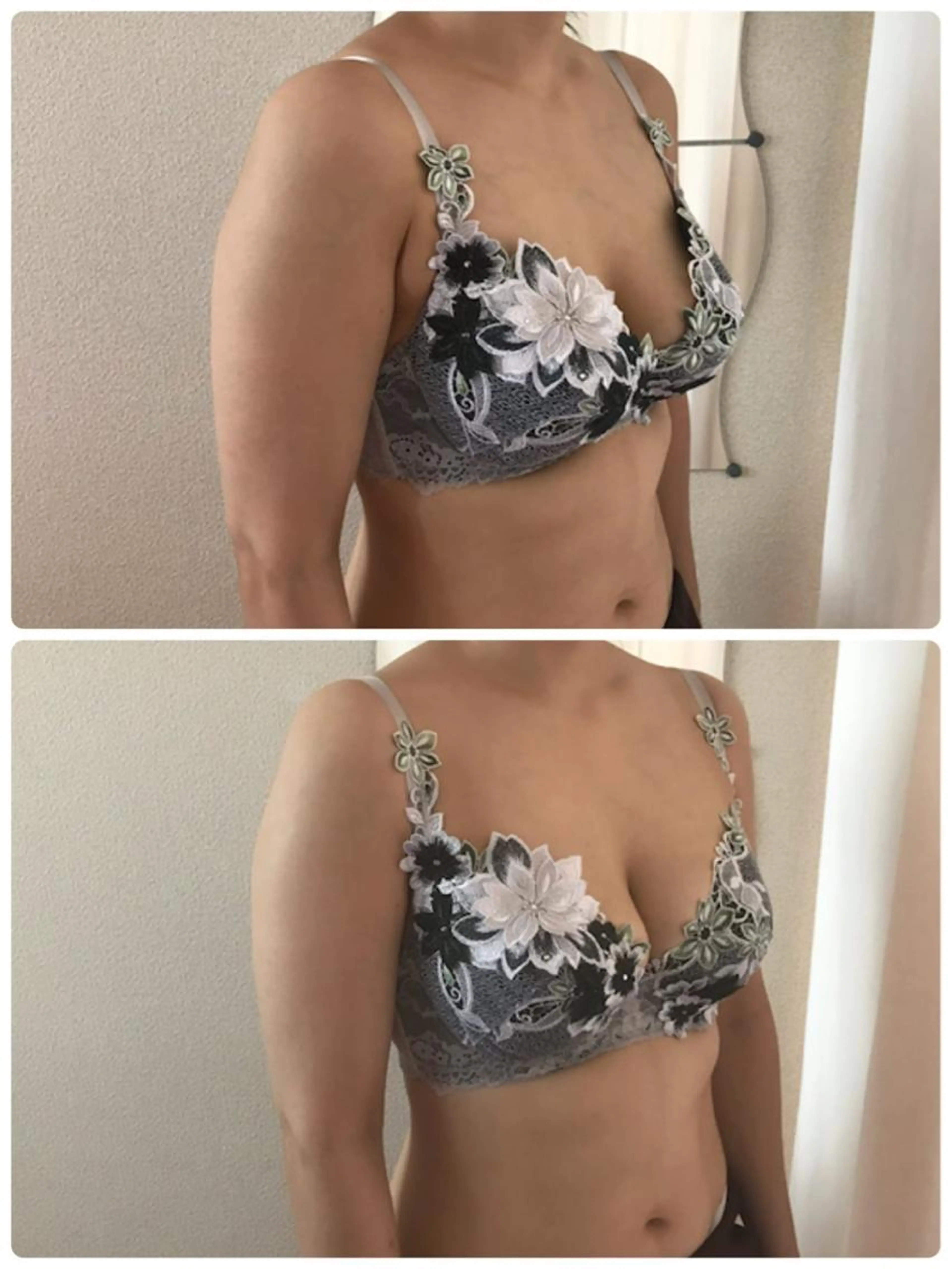 【都度払い】バストアップ痩身＊最終来店から2ヶ月以内の方の写真