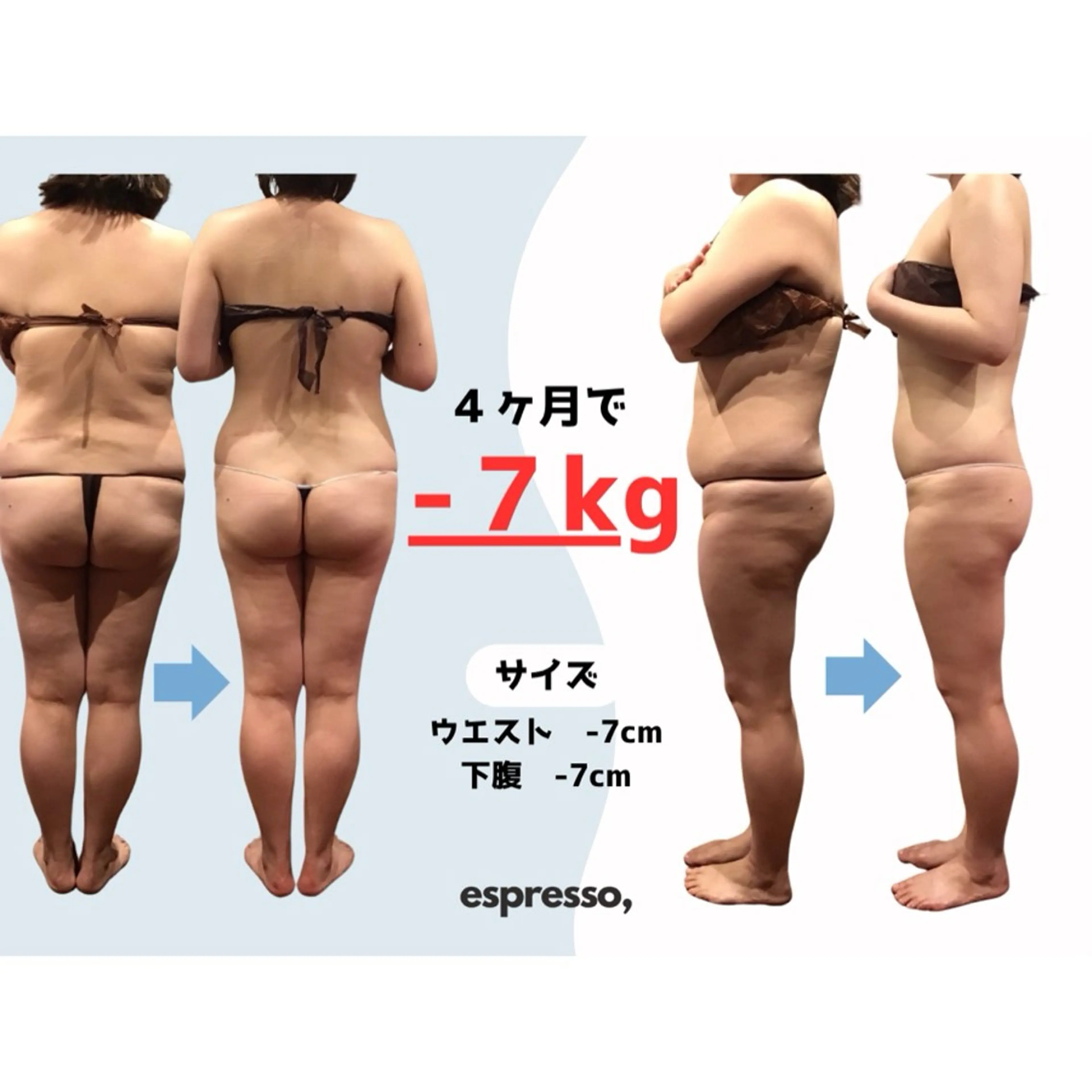 エステ リラク espresso,所属・《痩身、小顔専門店》 エスプレッソのエステ・リラクイメージ