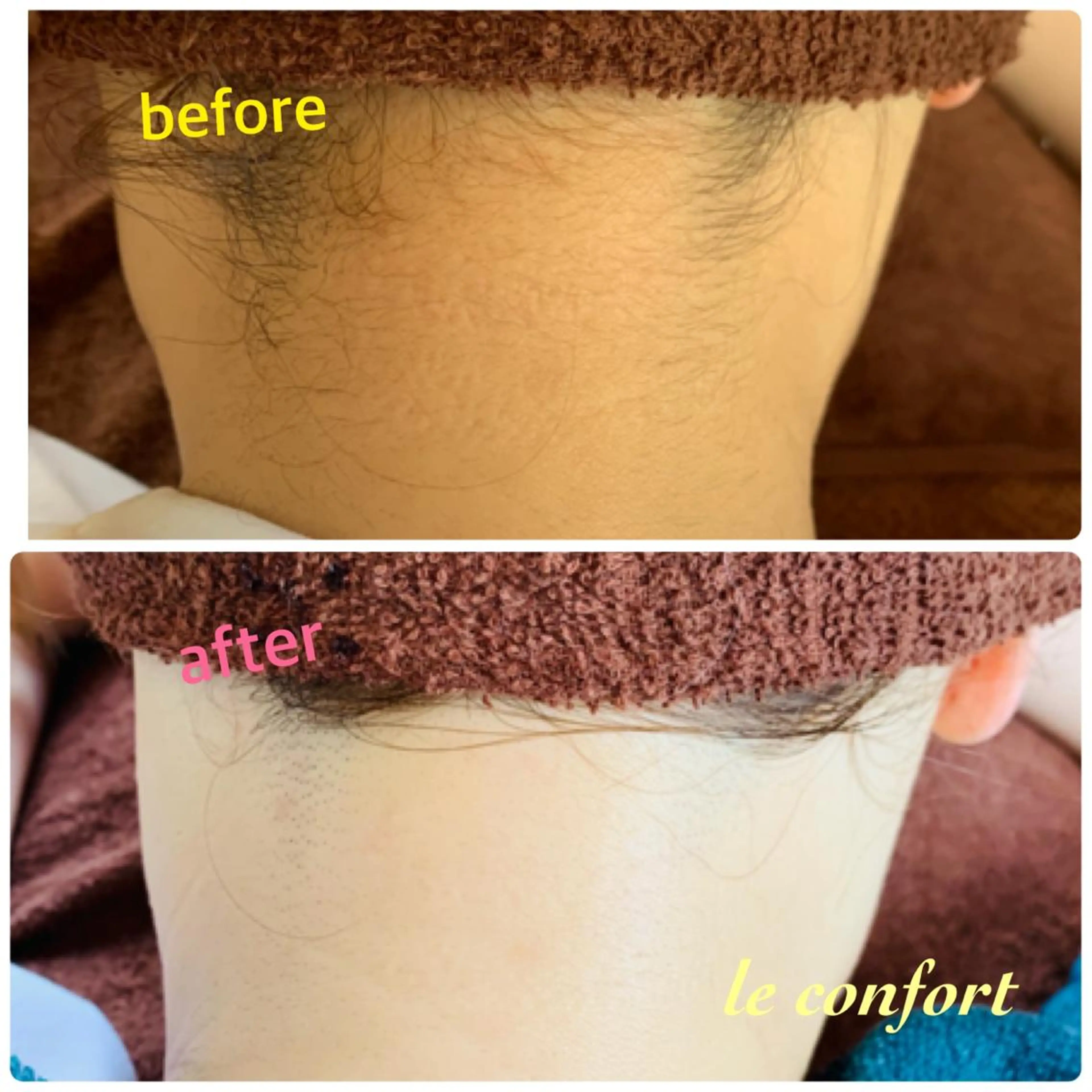 脱毛 長谷川 由美のエステ・リラクイメージ